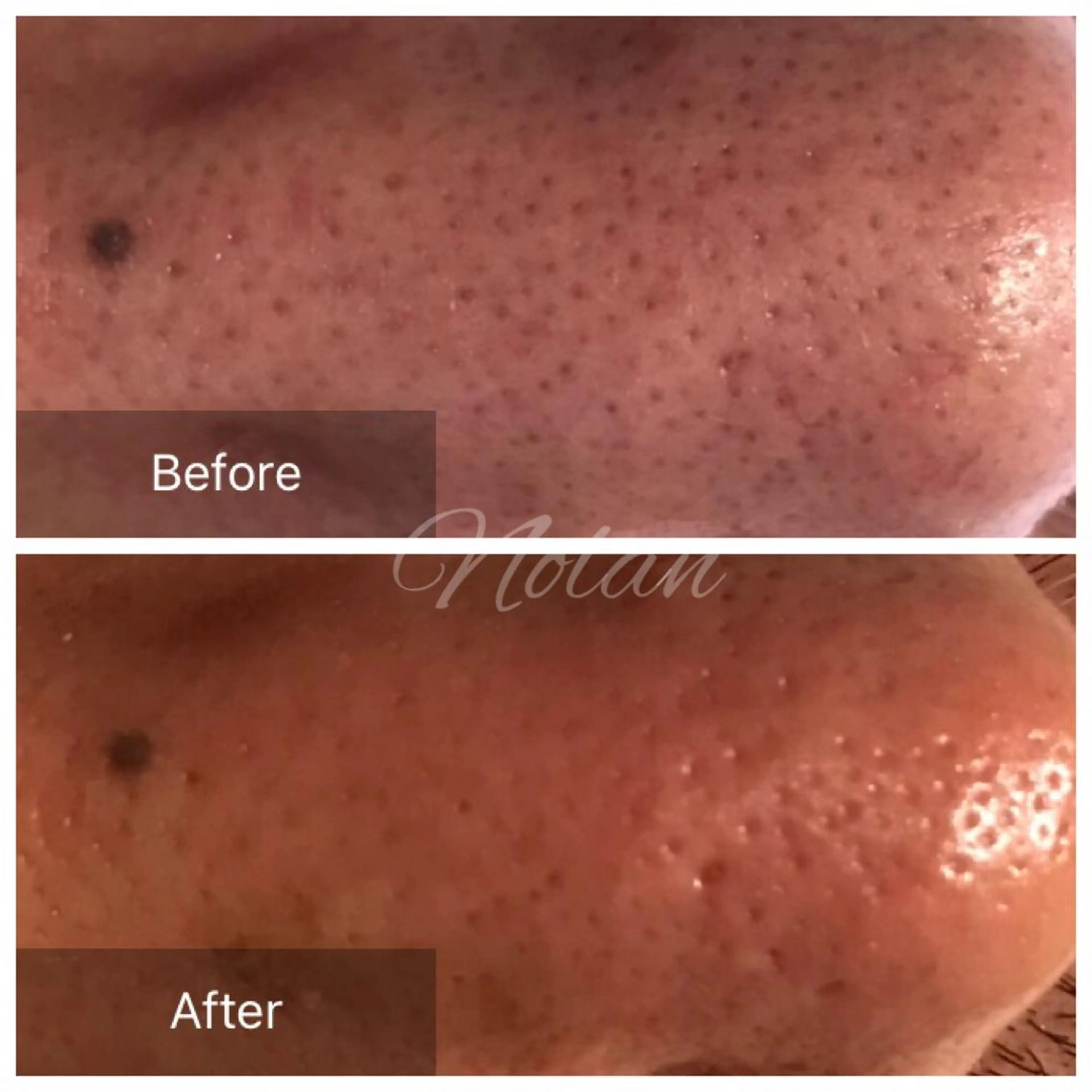 エステ Morisugi Natsumiのエステ・リラクイメージ