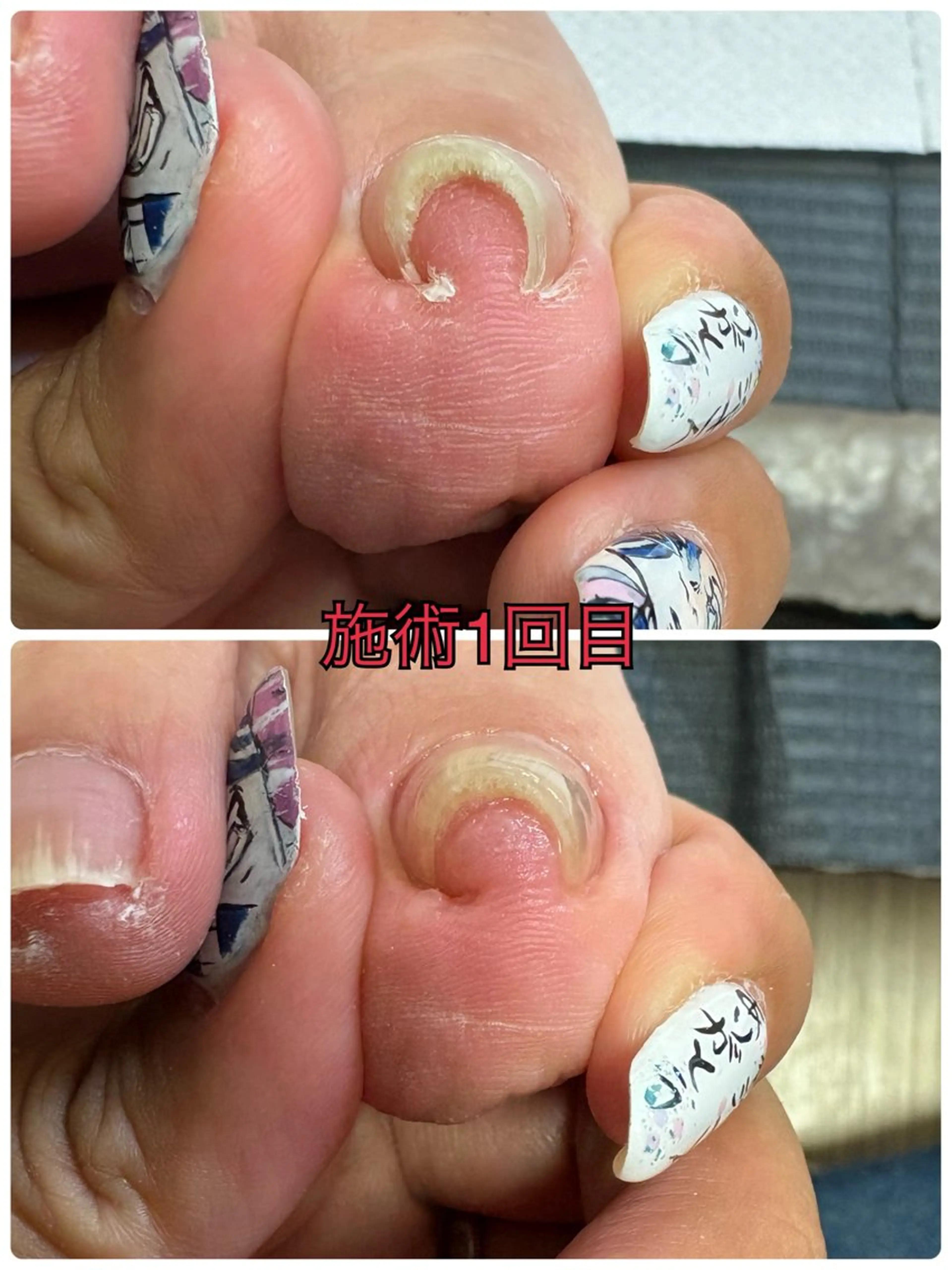 ネイル フットネイル -TOIRO- Eriのネイルデザイン