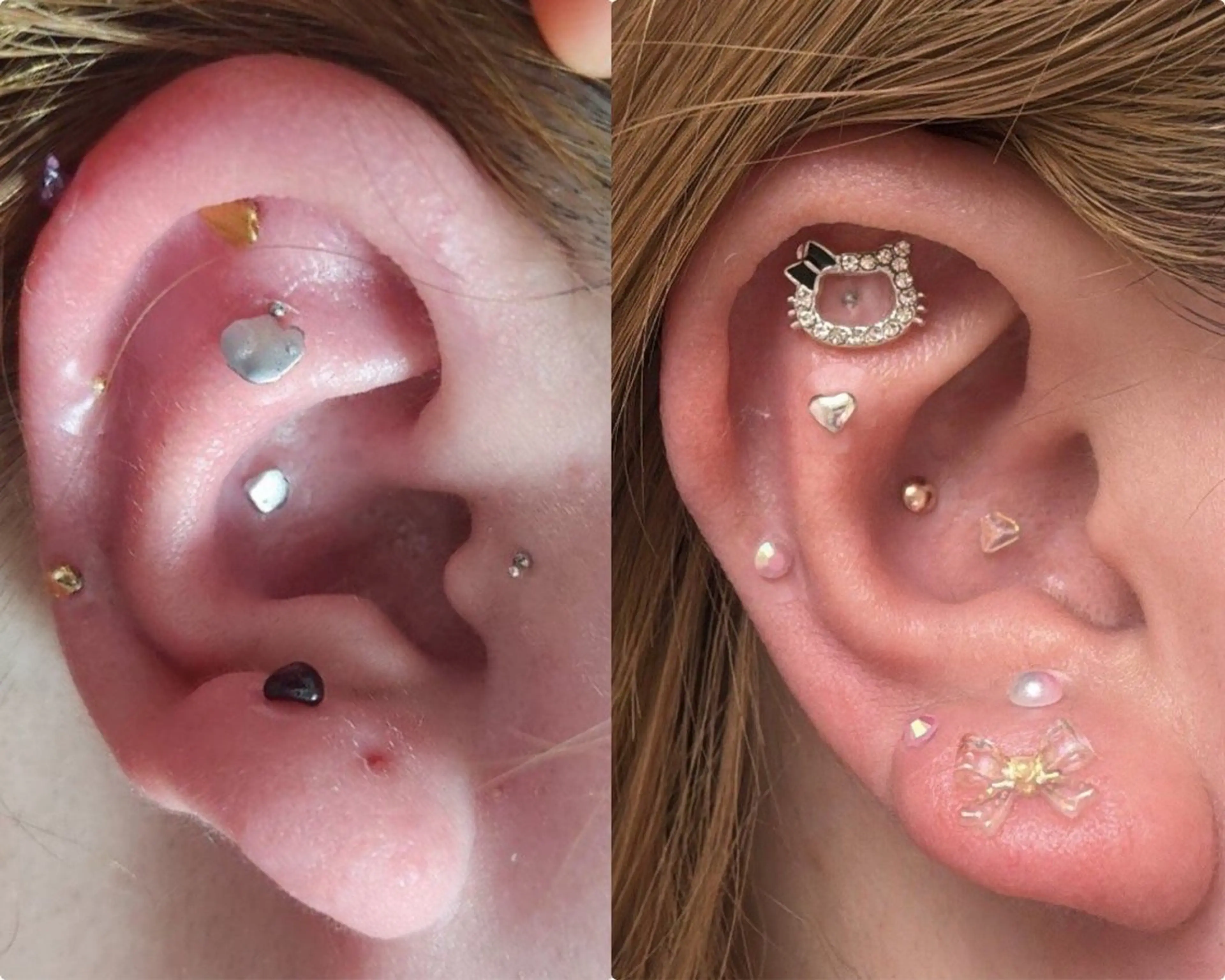 深層筋×筋膜リリース 首肩こり/むくみのエステ・リラクイメージ