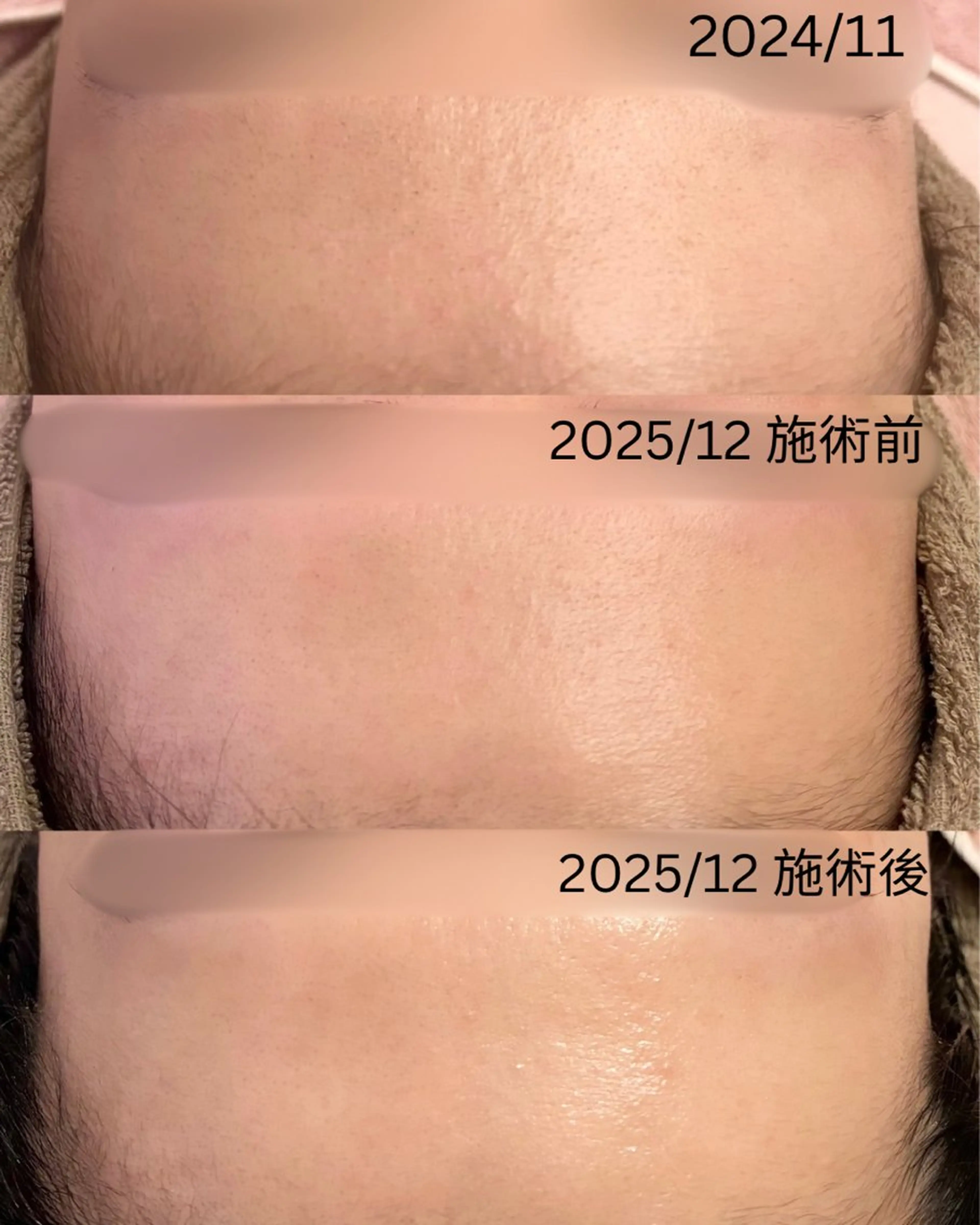 アイラッシュ&エステサロンLinda西宮所属・小顔&毛穴・肌質改善 LINDA西宮 AIのその他イメージ