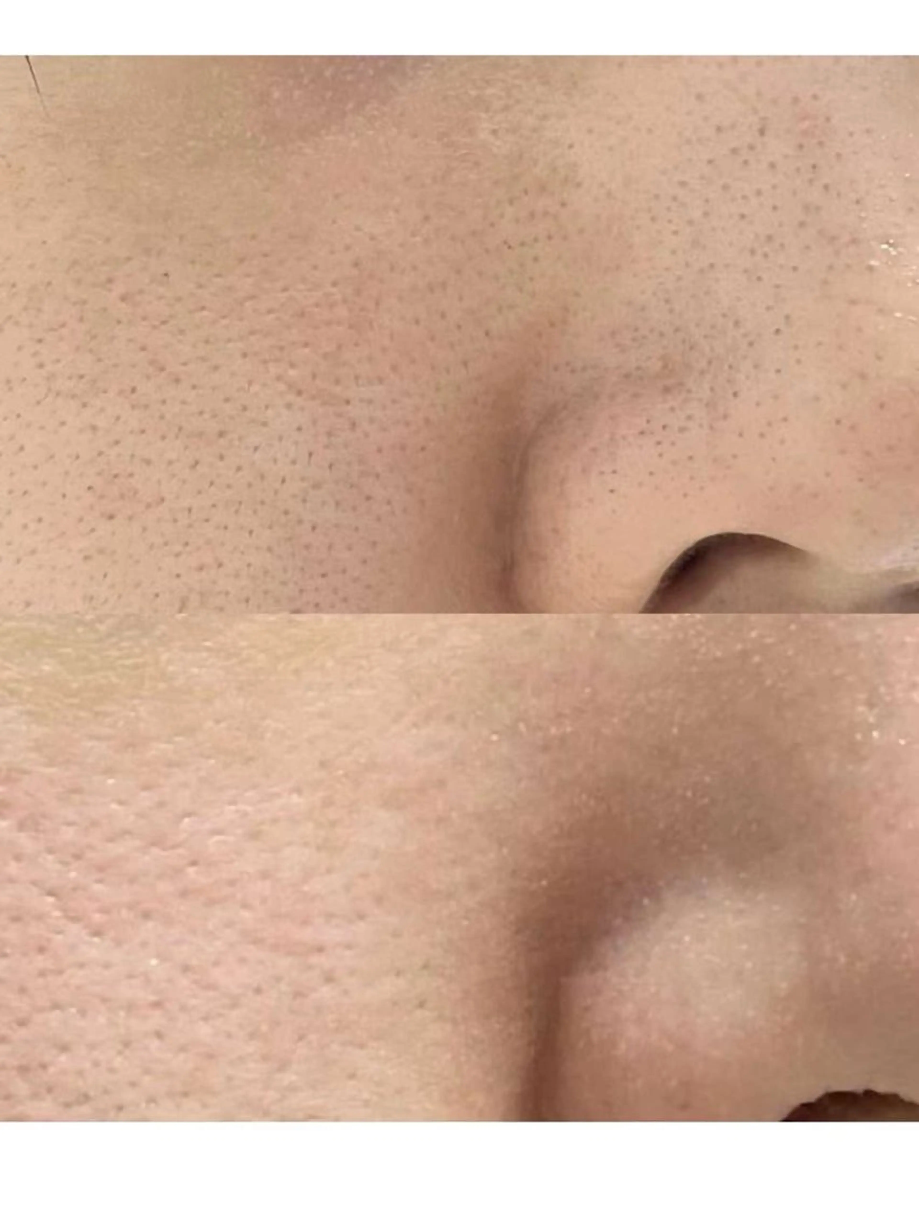 マツエク・マツパ エステ aliaハイフ&水光ジェットサロン所属・aliaハーブ水光店 エステティシャン募集のエステ・リラクイメージ