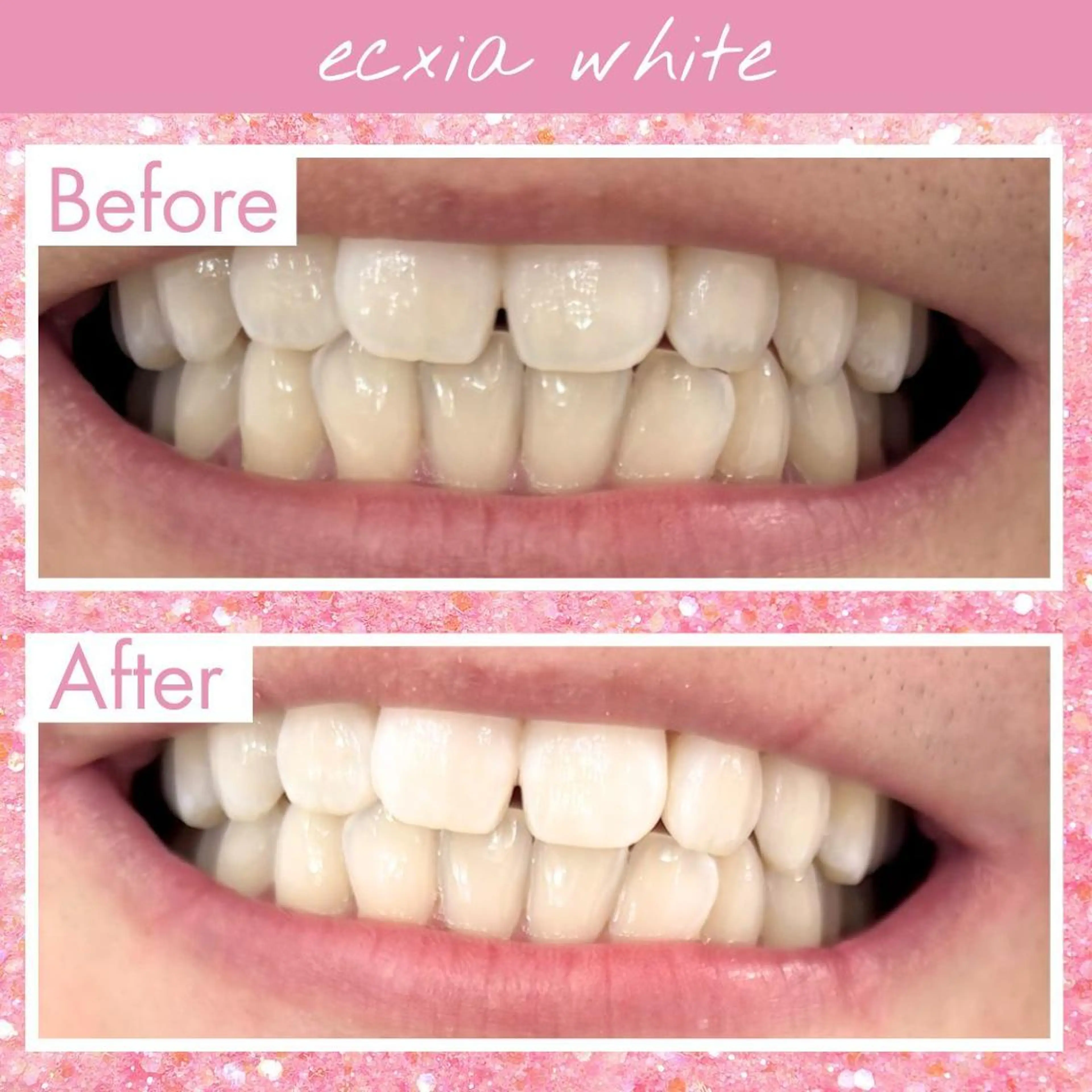 エクシアホワイト 💟mikuのその他イメージ