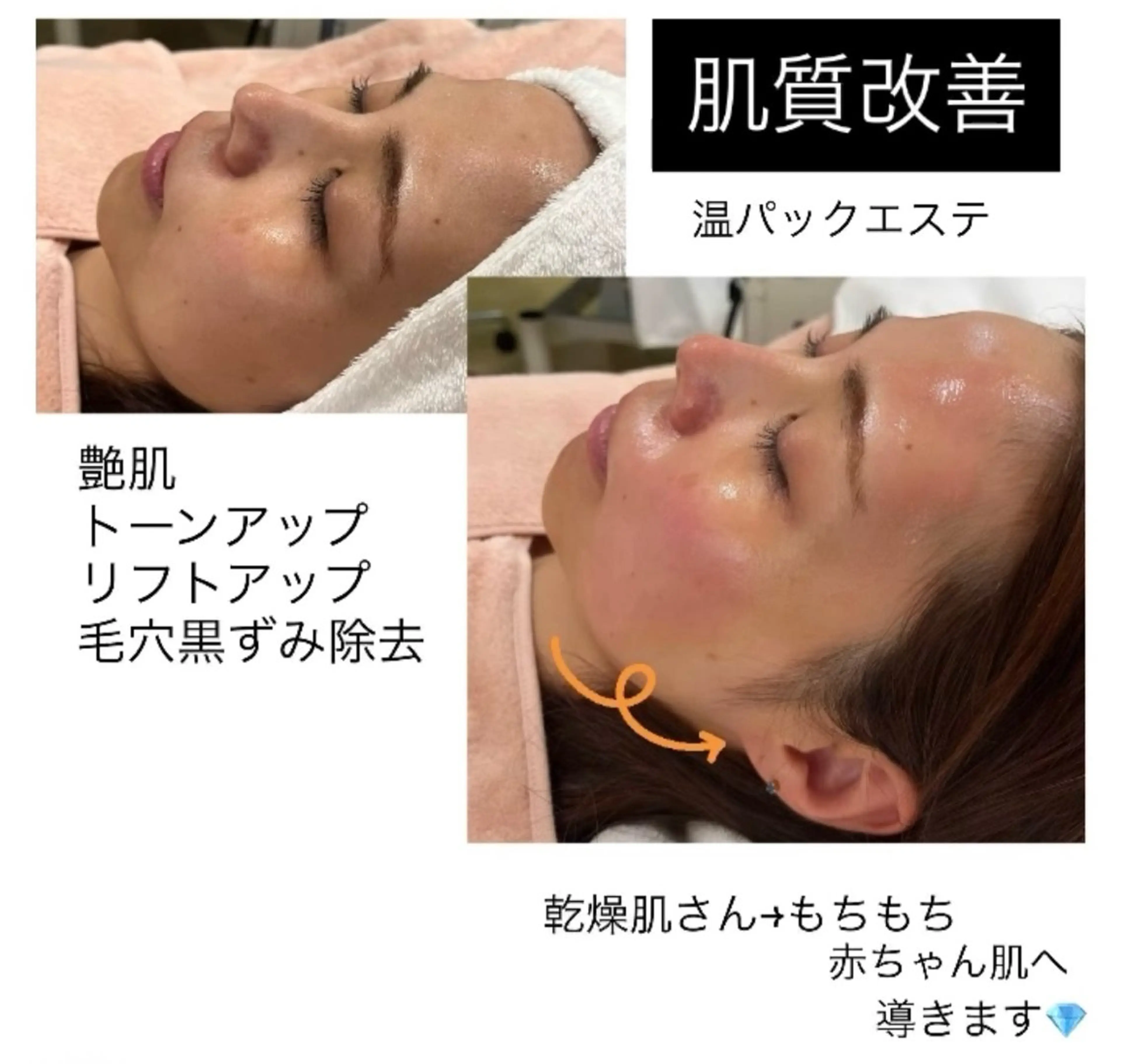 温パックエステ（Waxエステ）の写真