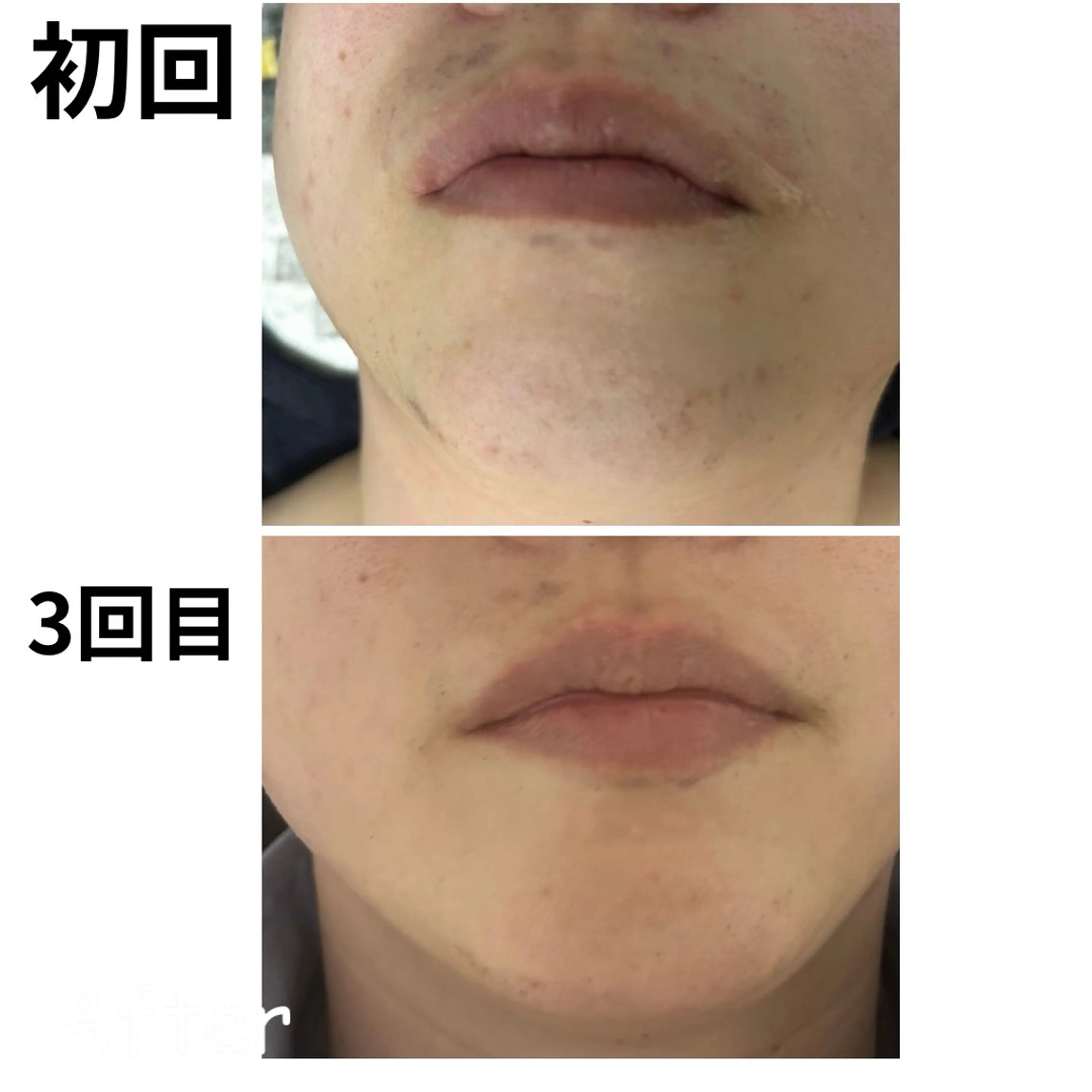 メンズ エマニエル USAのエステ・リラクイメージ