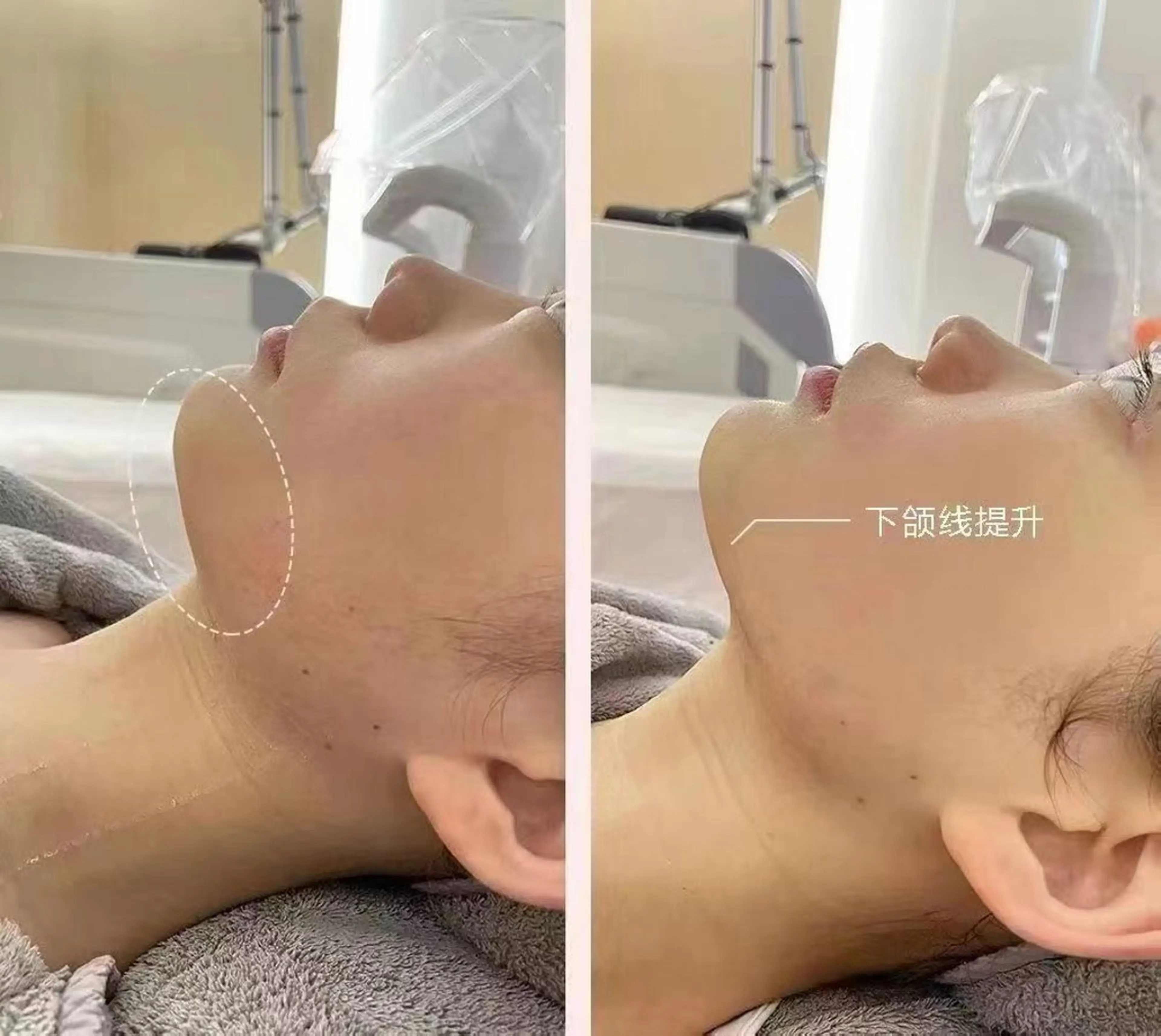 マツエク・マツパ エステ aliaハーブ水光店 エステティシャン募集のエステ・リラクイメージ