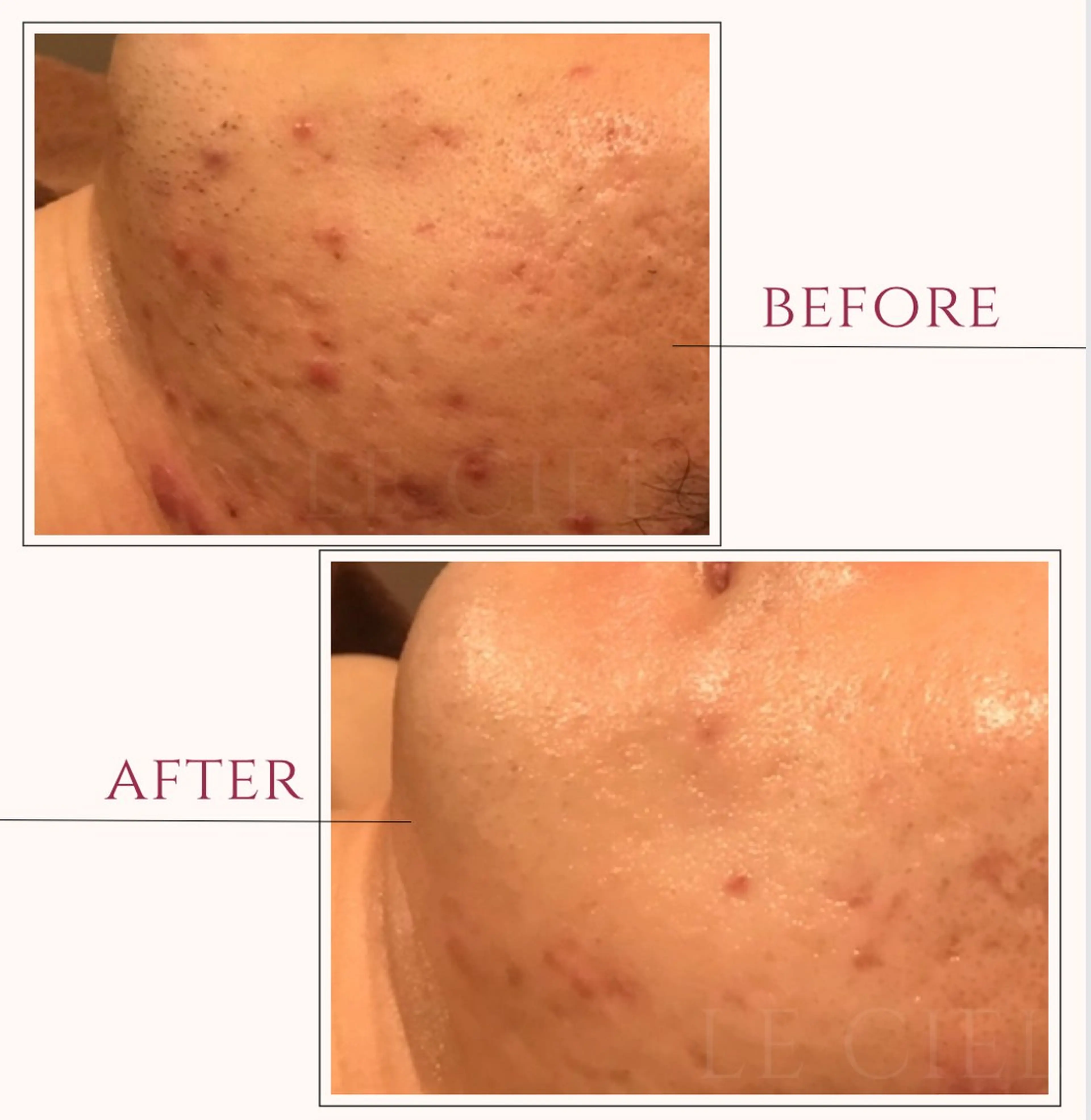 サロンドゥ ルシエルのエステ・リラクイメージ