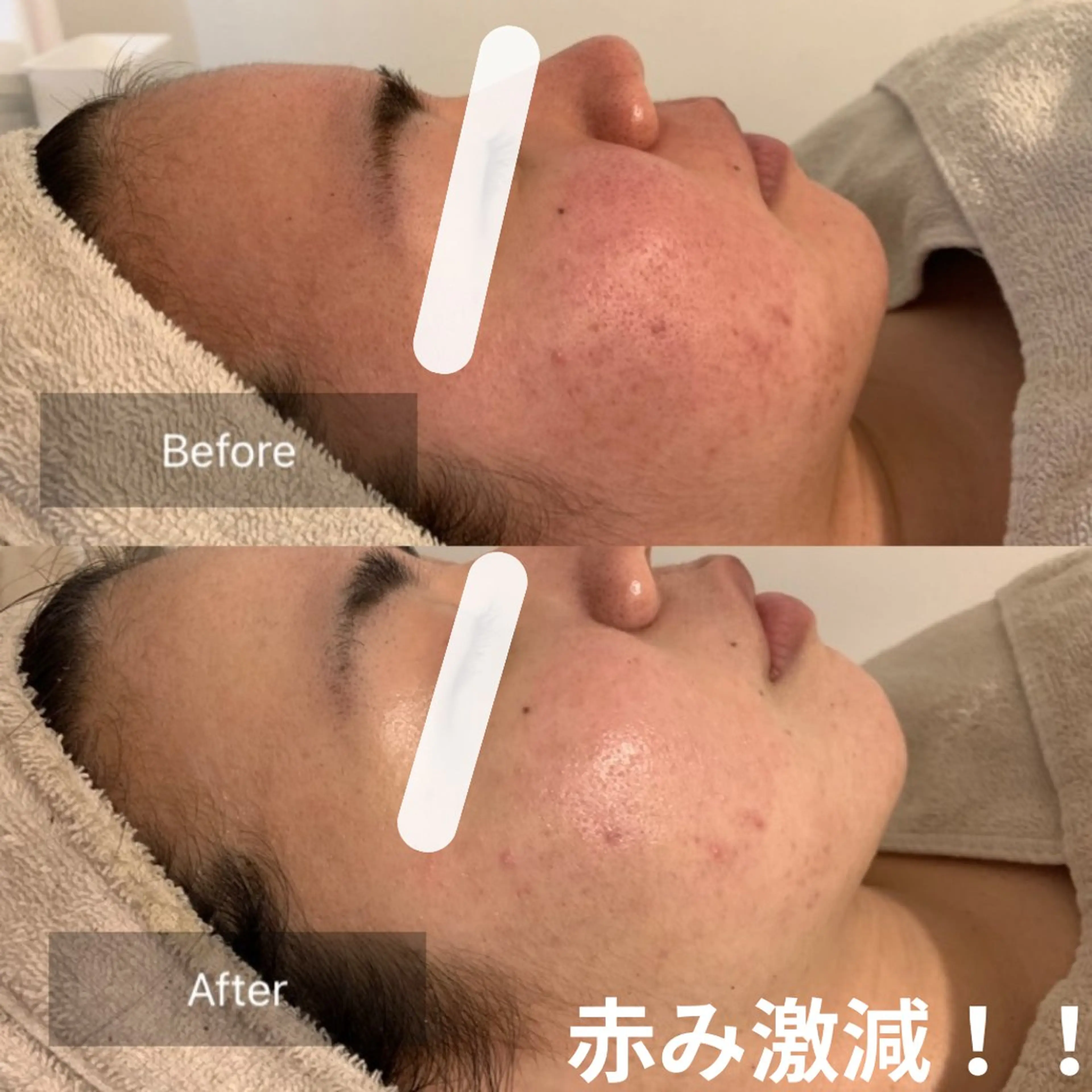 エステ 松山 舞衣のエステ・リラクイメージ