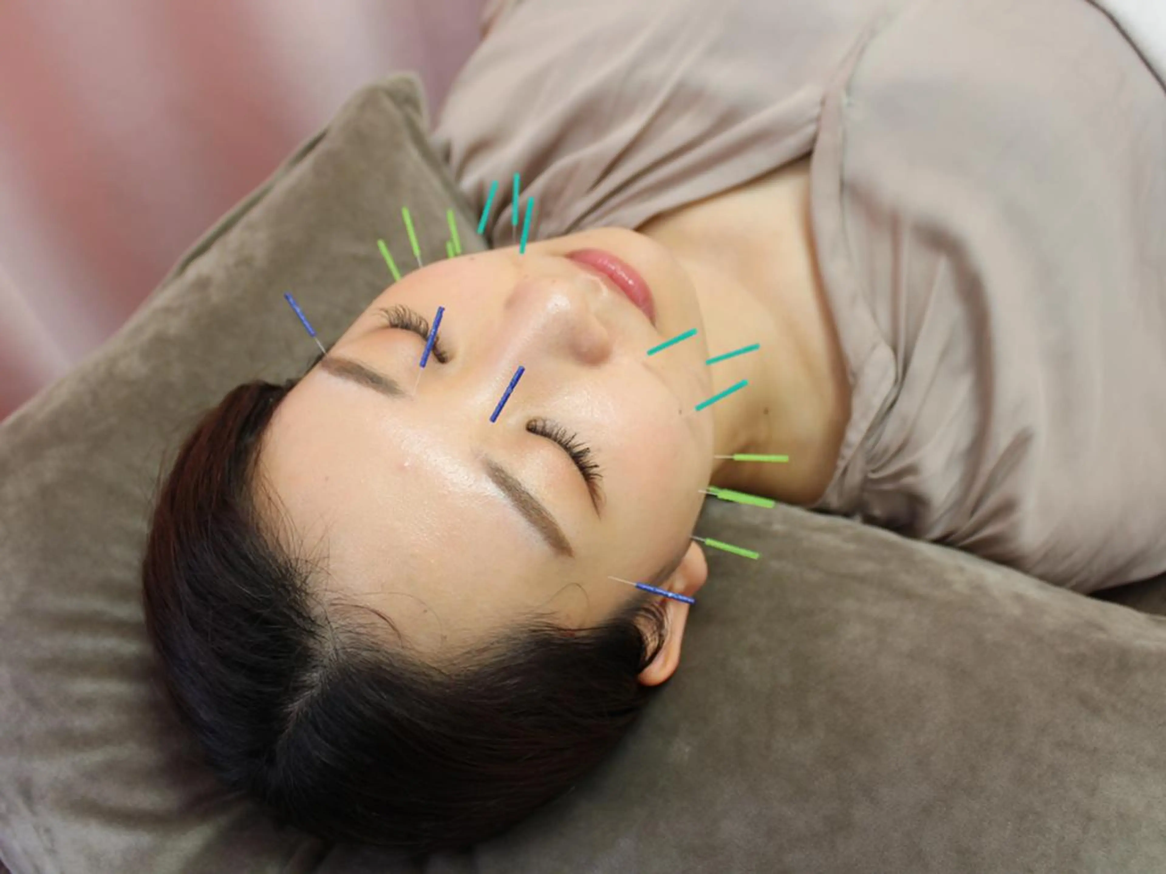 エステ リラク 同心整骨院 美容鍼・整体・小顔のエステ・リラクイメージ