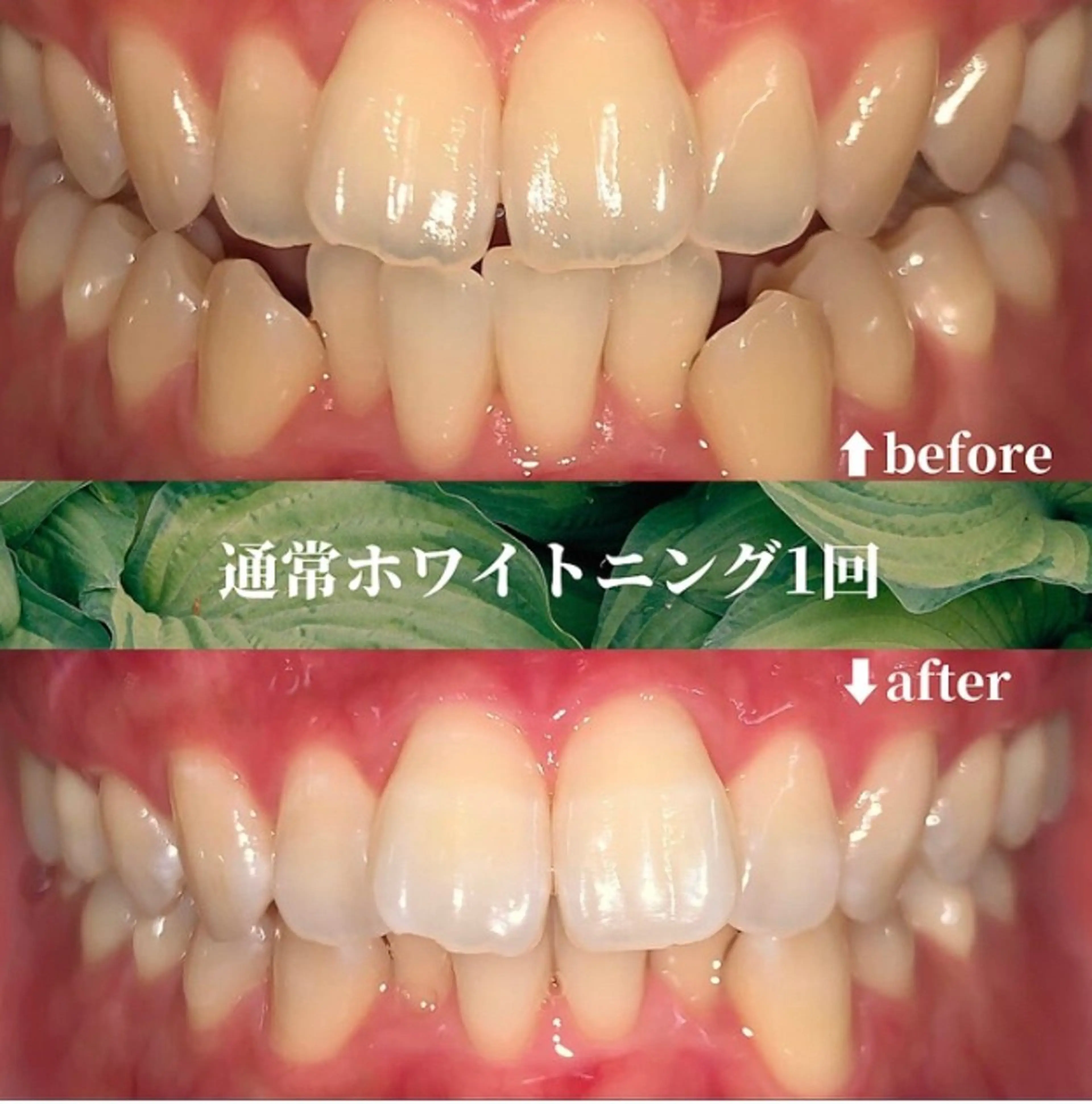 futaba ホワイトニング/天神のエステ・リラクイメージ