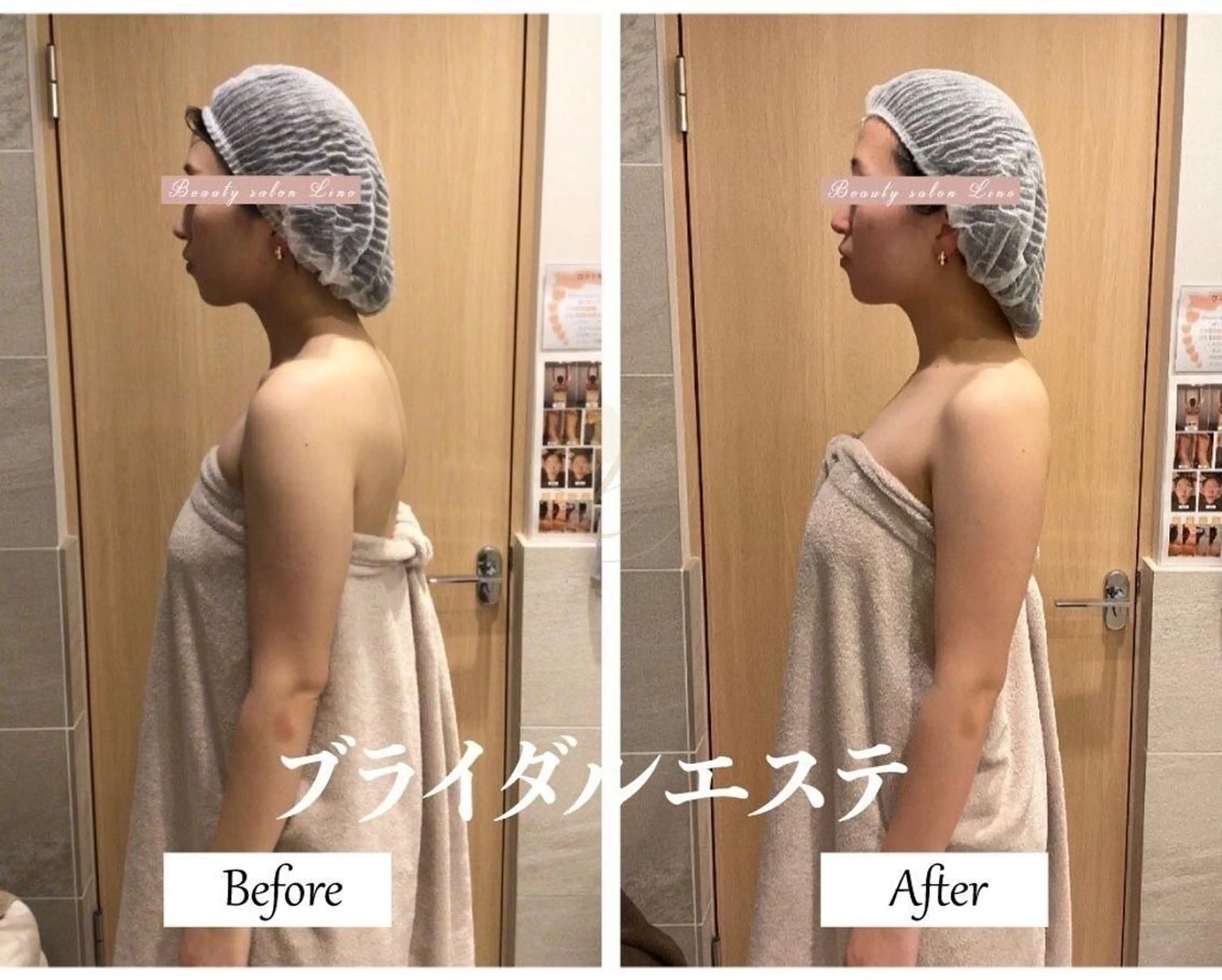 ブライダルサロン ｜Lino【堀江】のエステ・リラクイメージ