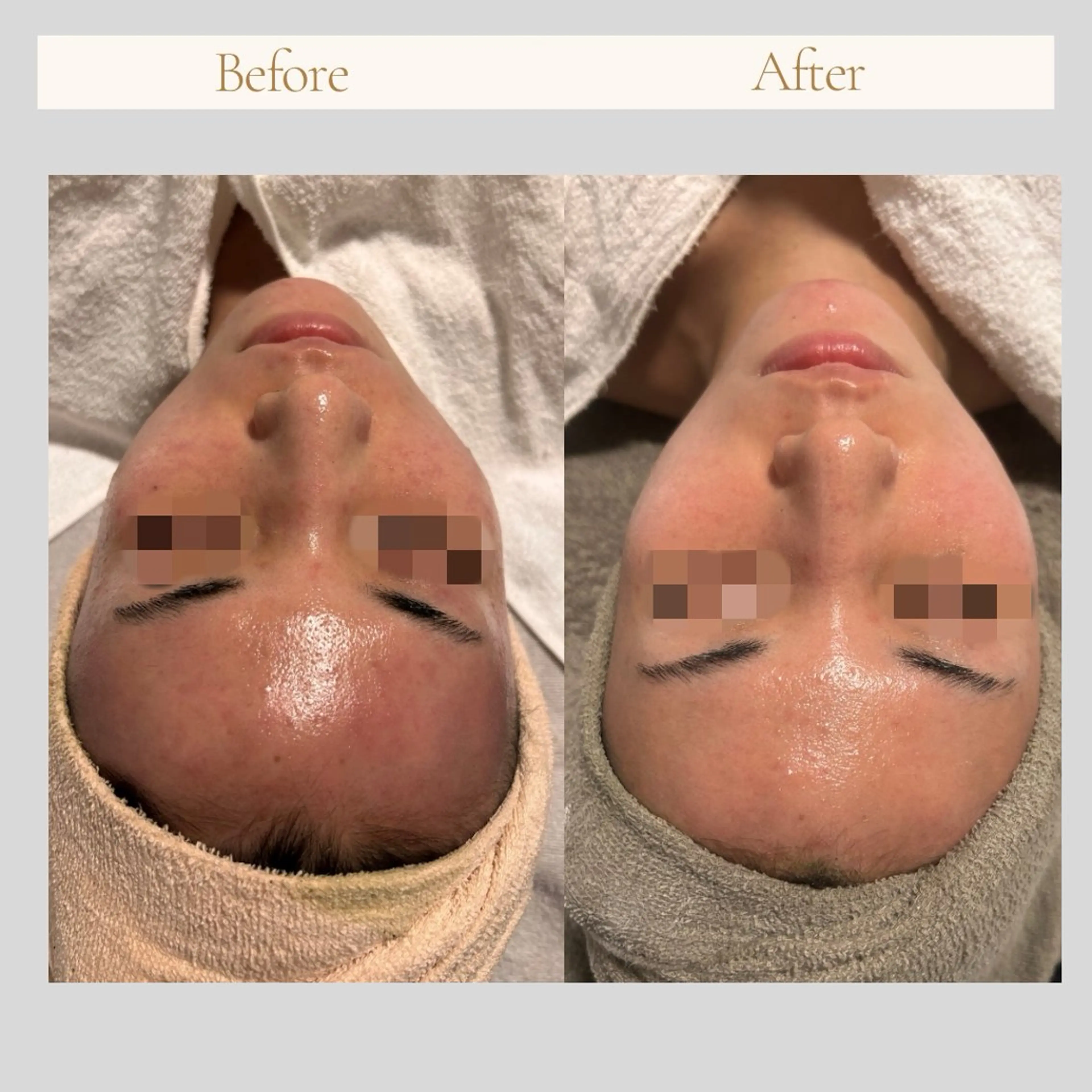 lumi riseのエステ・リラクイメージ