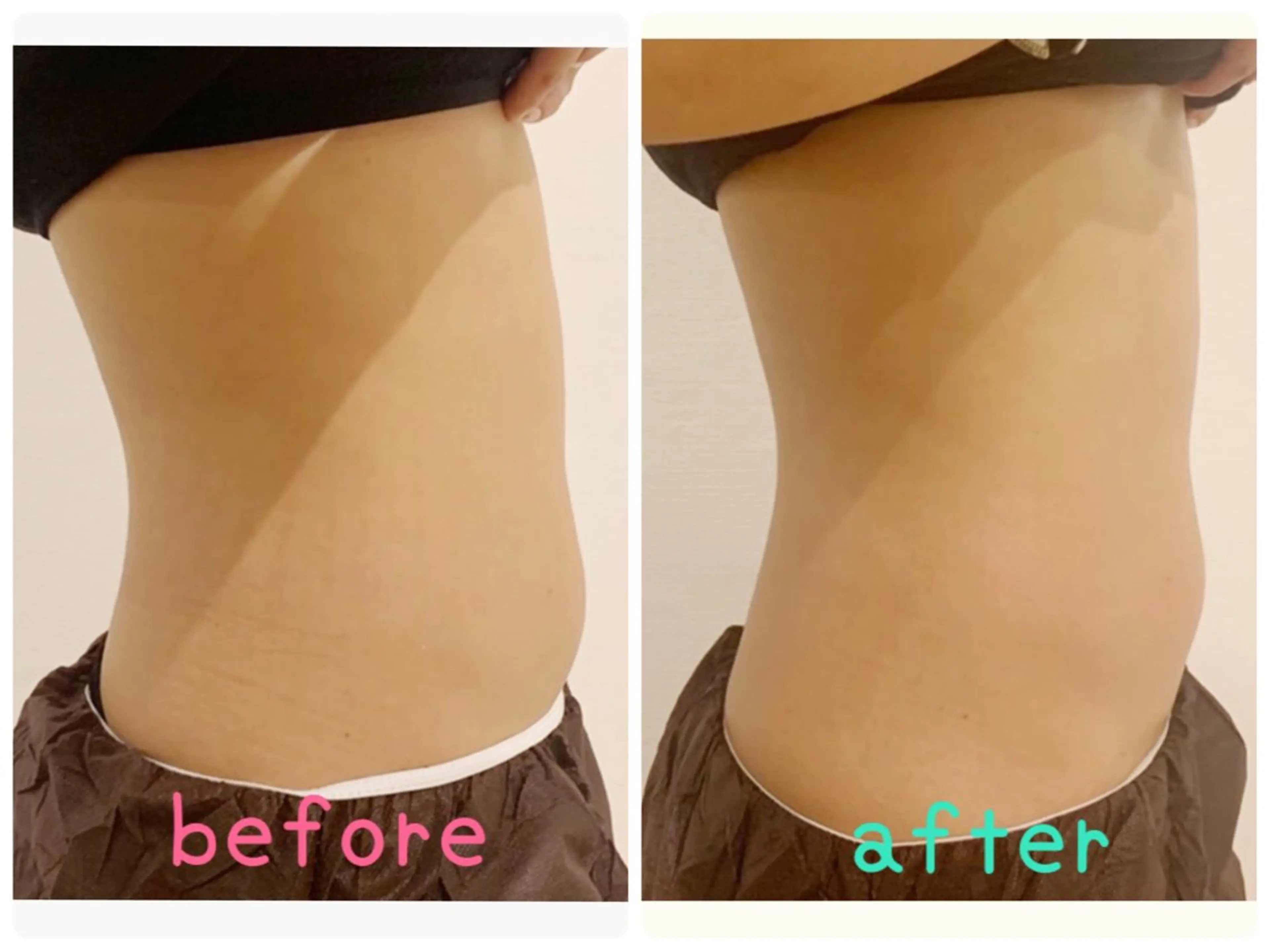 HappIness 遠赤外線ドームのエステ・リラクイメージ