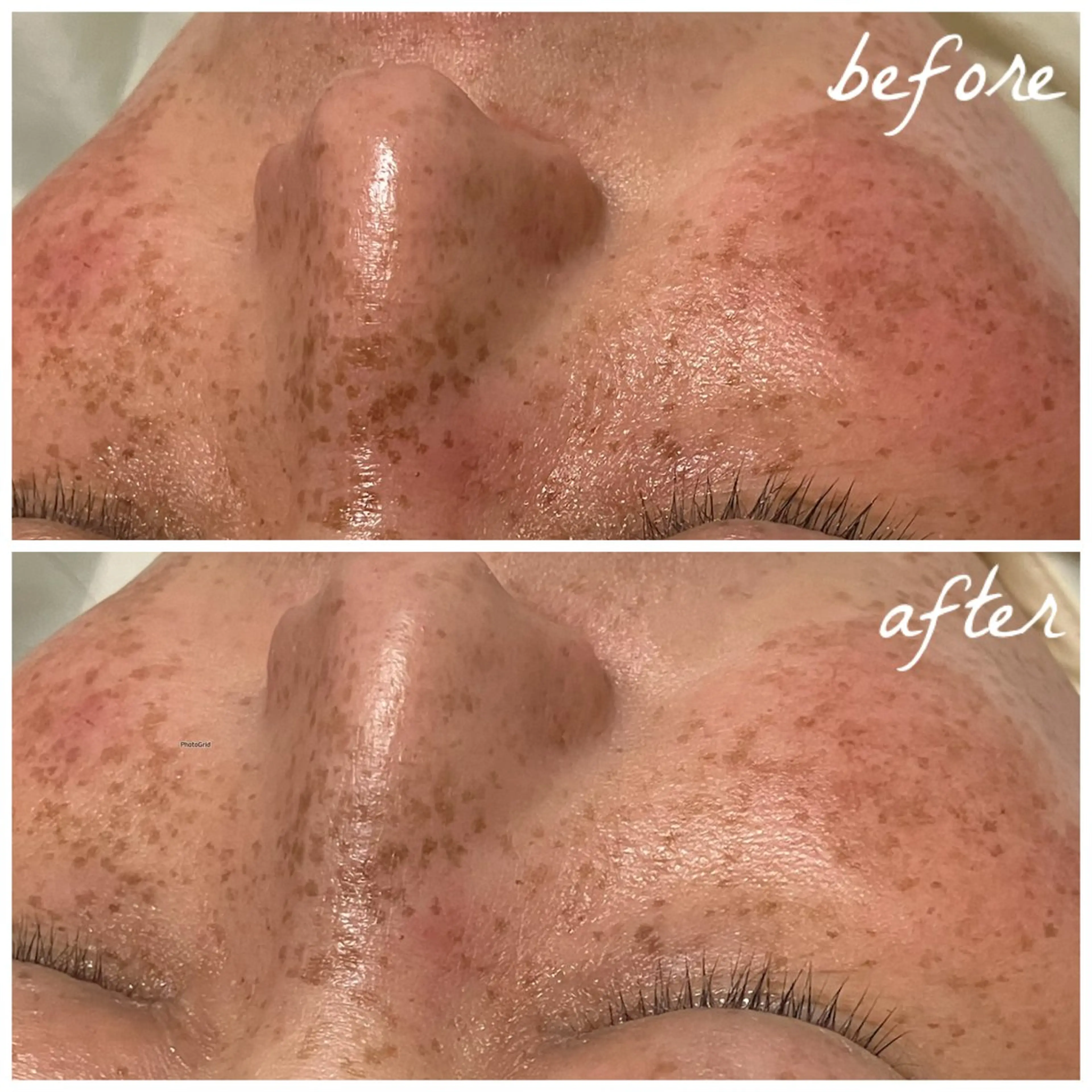 メンズ エステ メナード岐阜茜部 杉浦のエステ・リラクイメージ