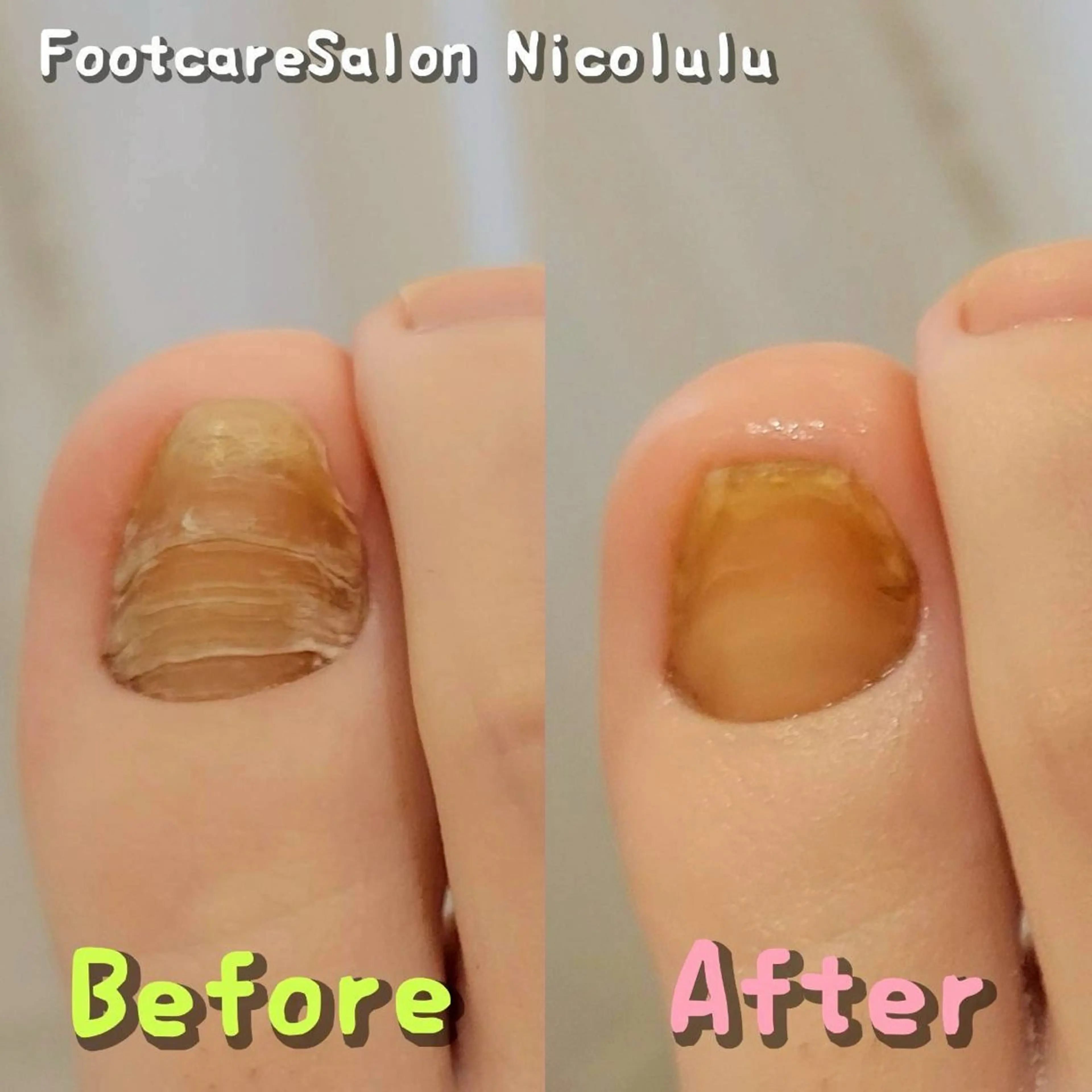 メンズ 足トラブル専門 ニコルル金沢のエステ・リラクイメージ