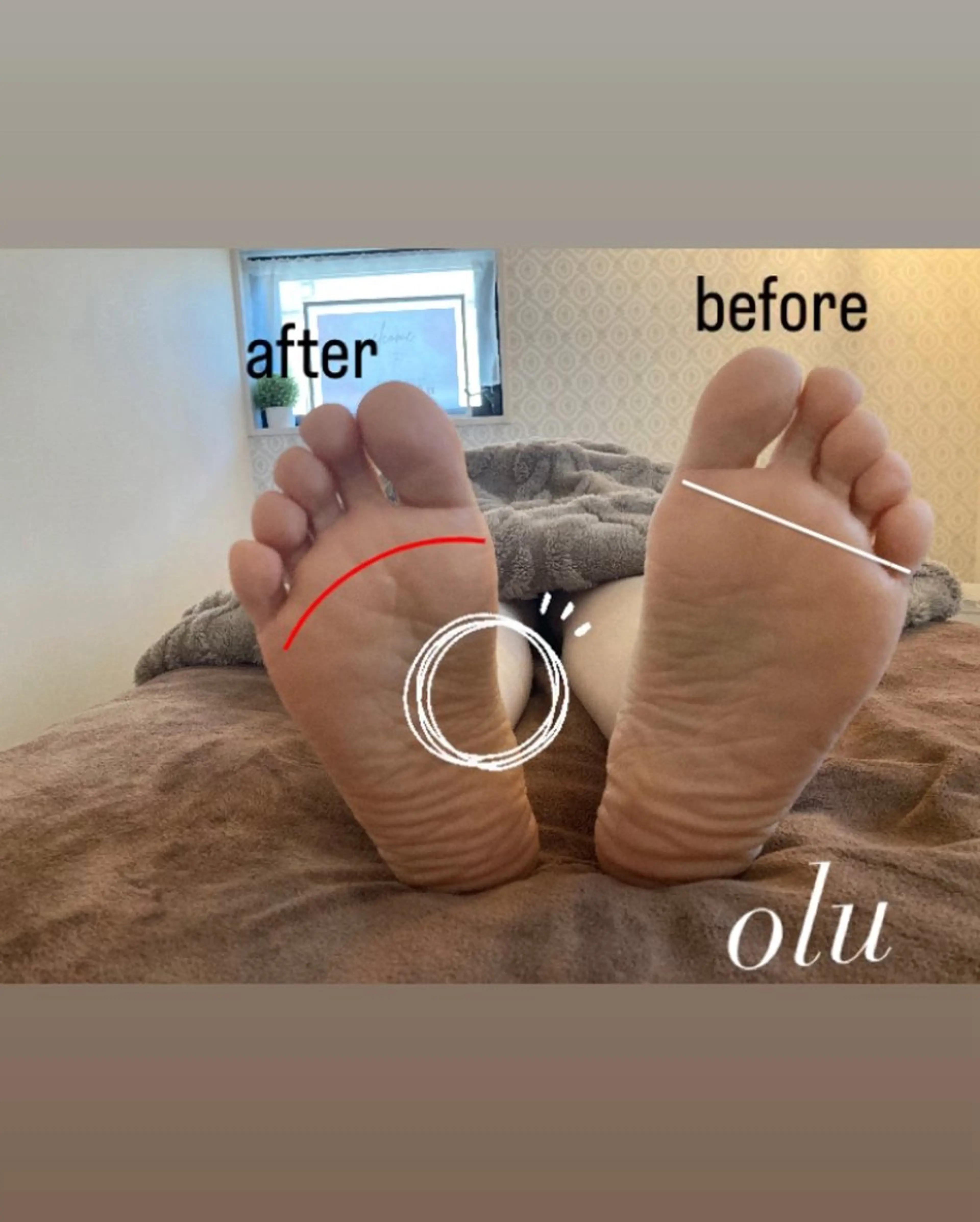 【体の土台となる足ケア】足のアーチケアができる！足背面アロマトリートメント&Remove Lock Style.ケアの写真