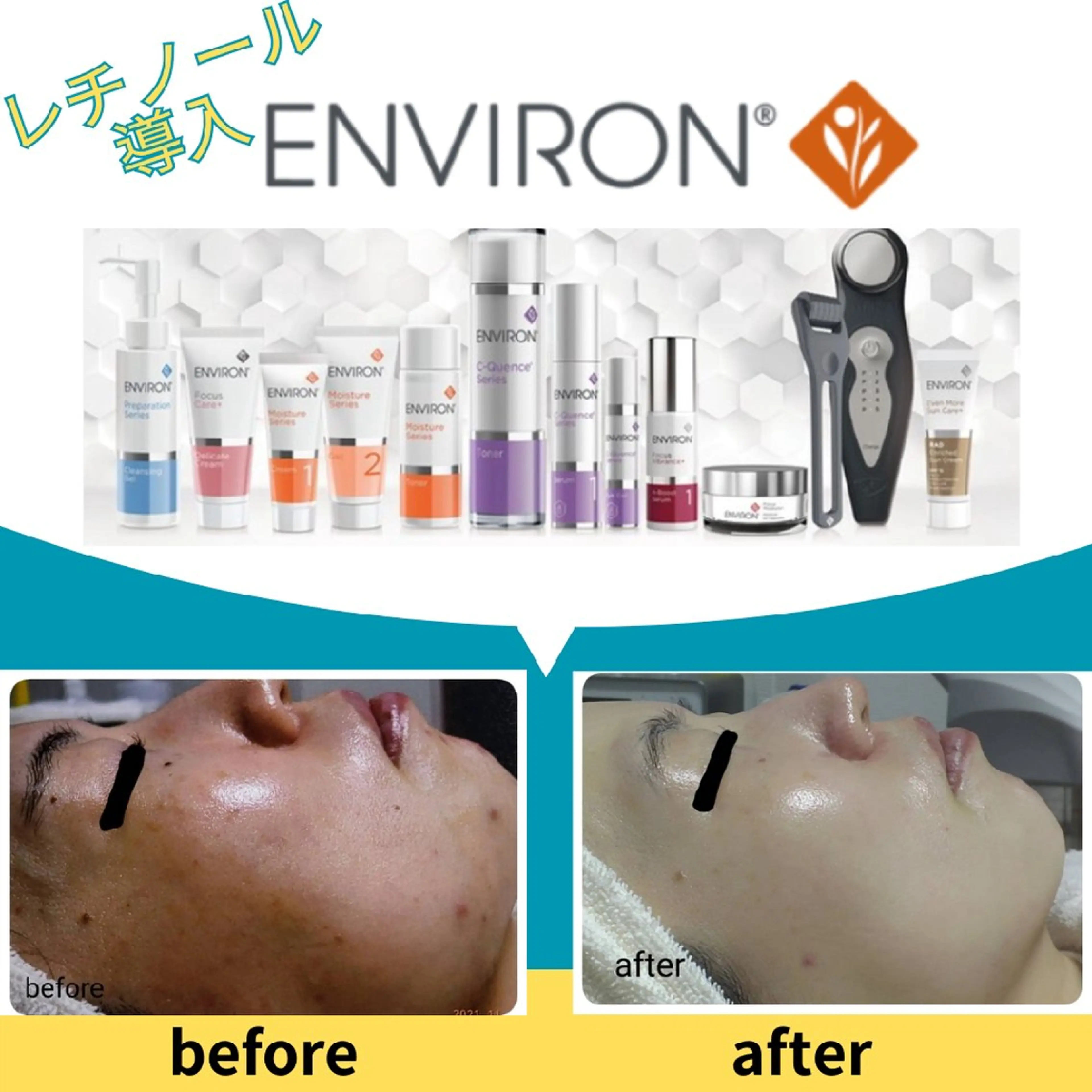 〈ニキビケアサロン〉 レゾン京橋店/ 浅川のエステ・リラクイメージ