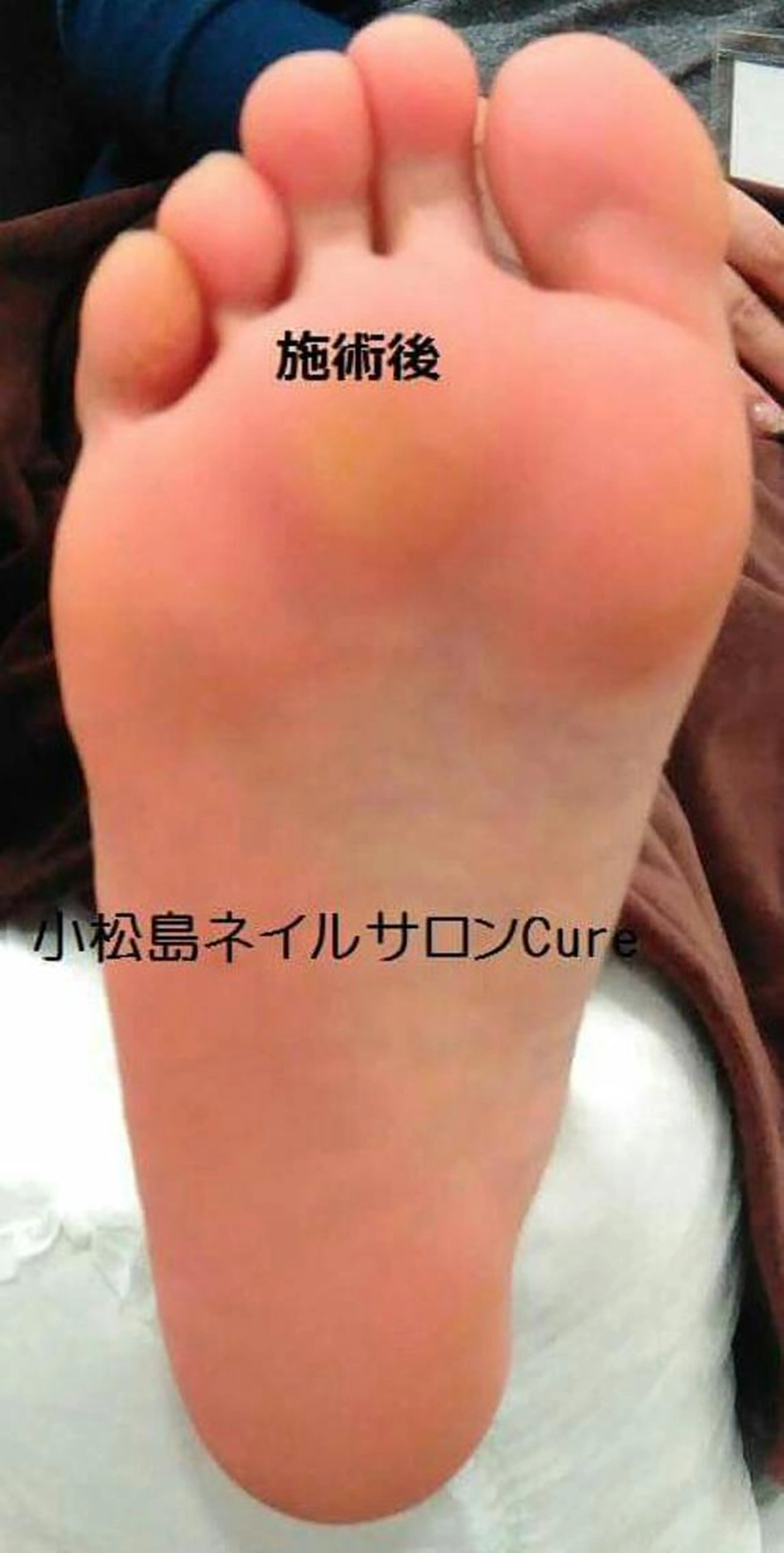 リフレッシュコースの写真