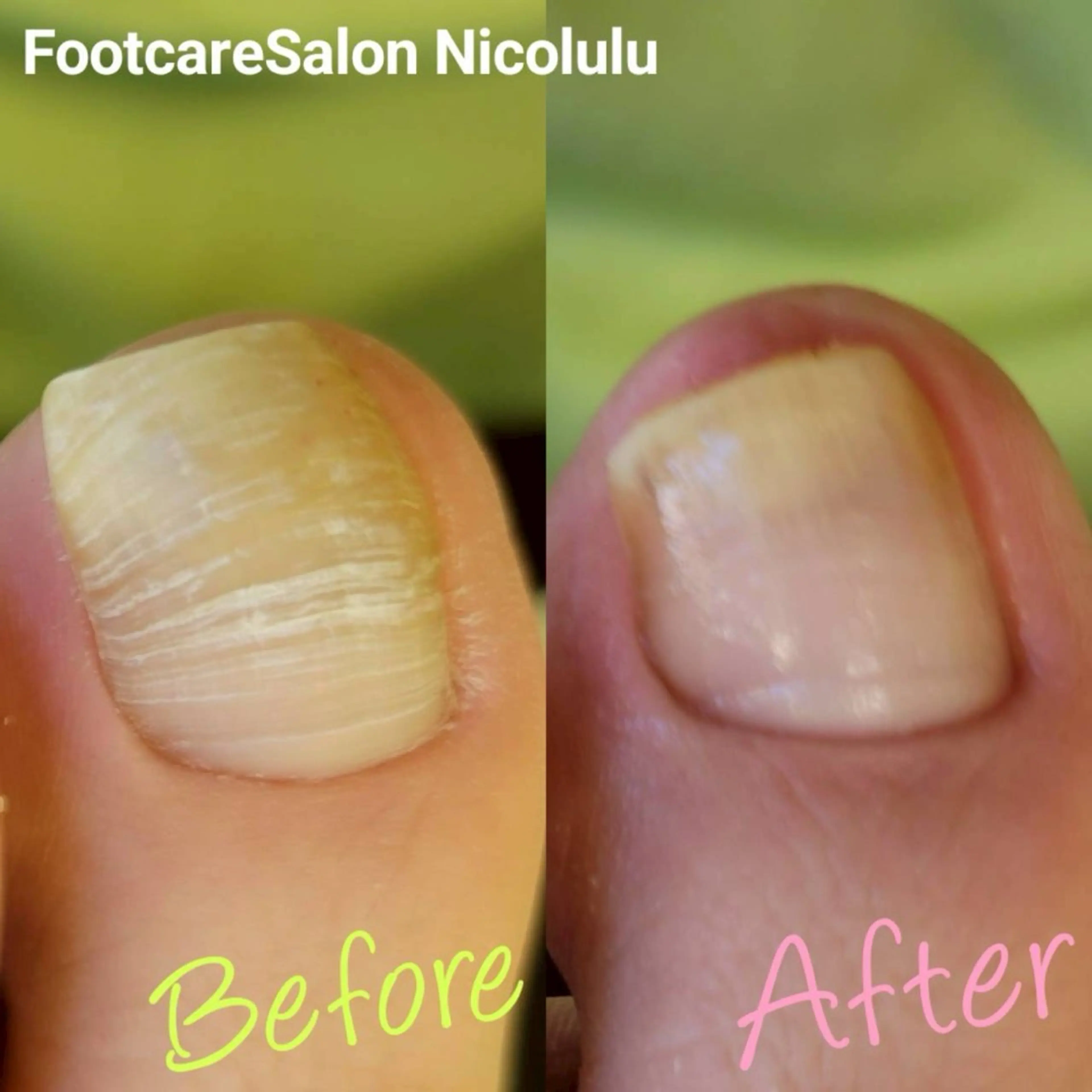 足トラブル専門 ニコルル金沢のエステ・リラクイメージ