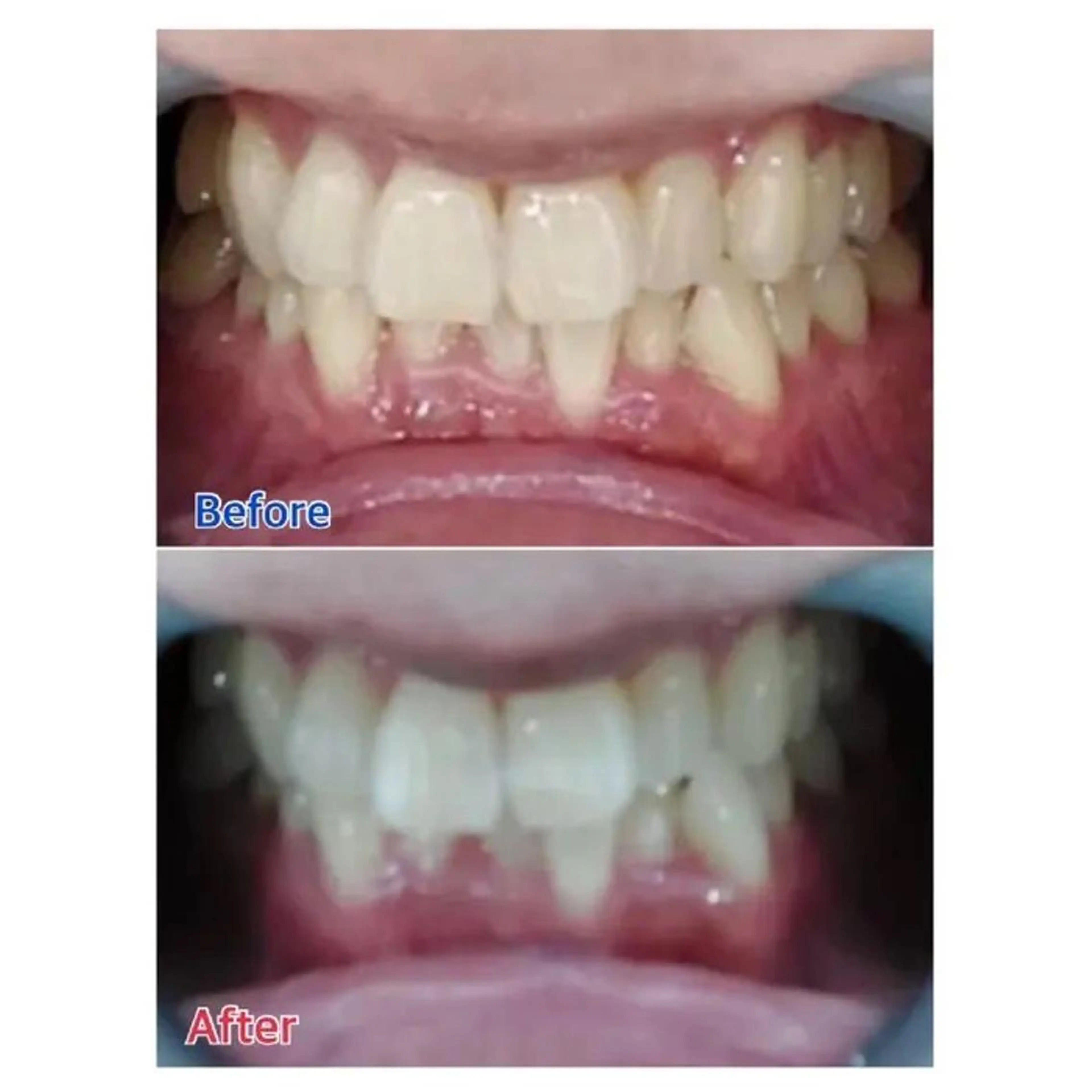 M渋谷 ホワイトニングのエステ・リラクイメージ