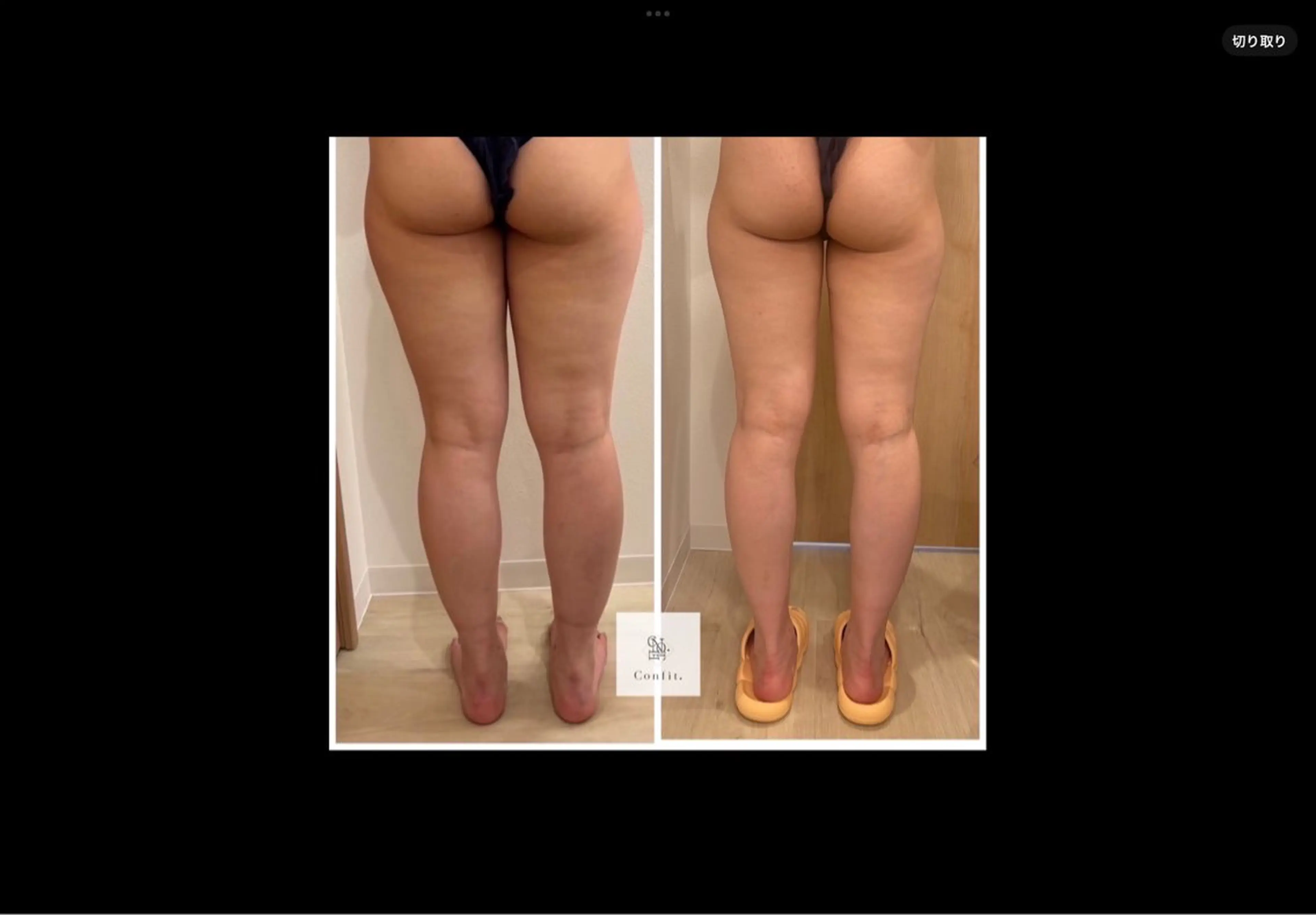 その他 Micell beautyのエステ・リラクイメージ