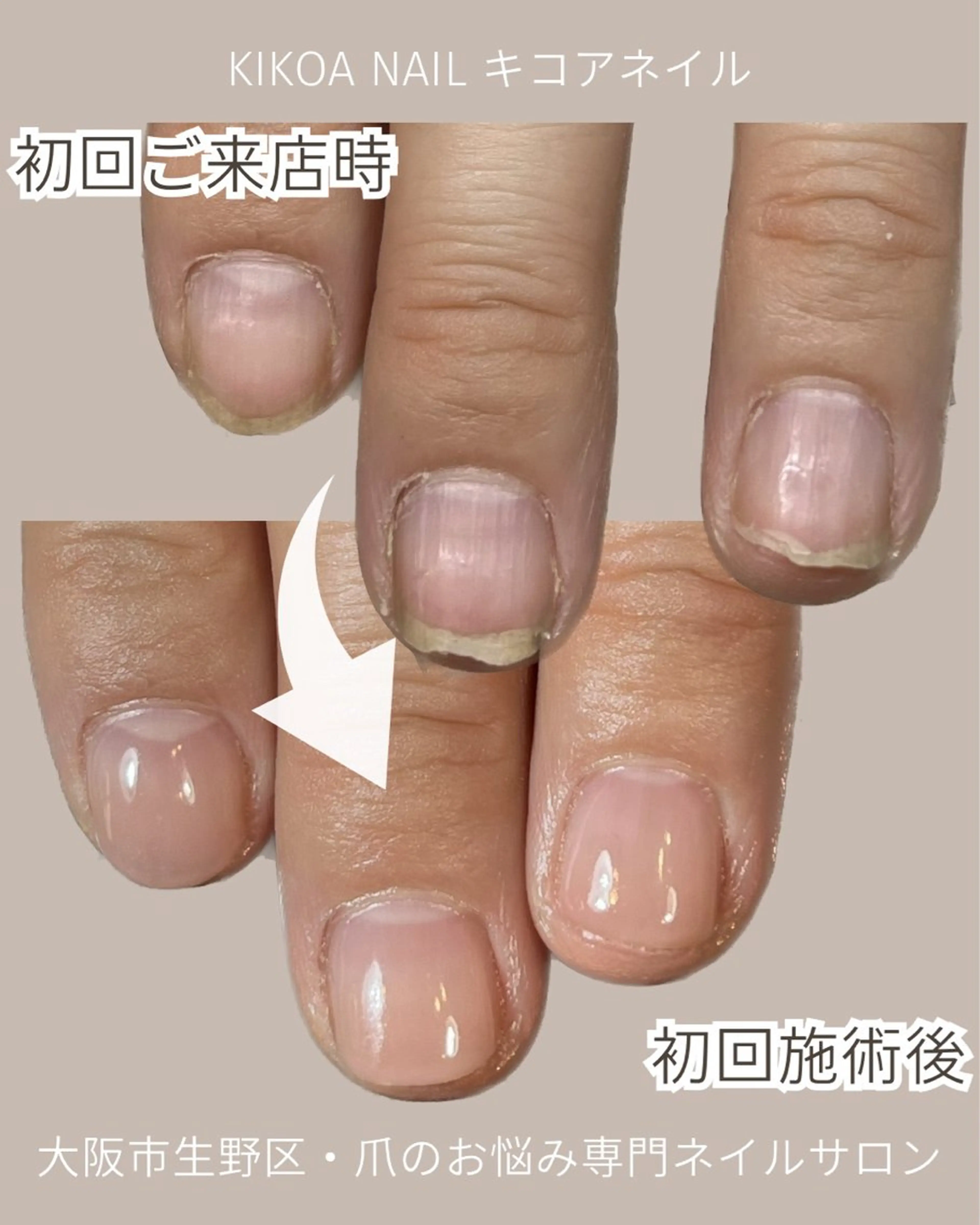 ネイル KIKOA NAIL キコアネイルのネイルデザイン