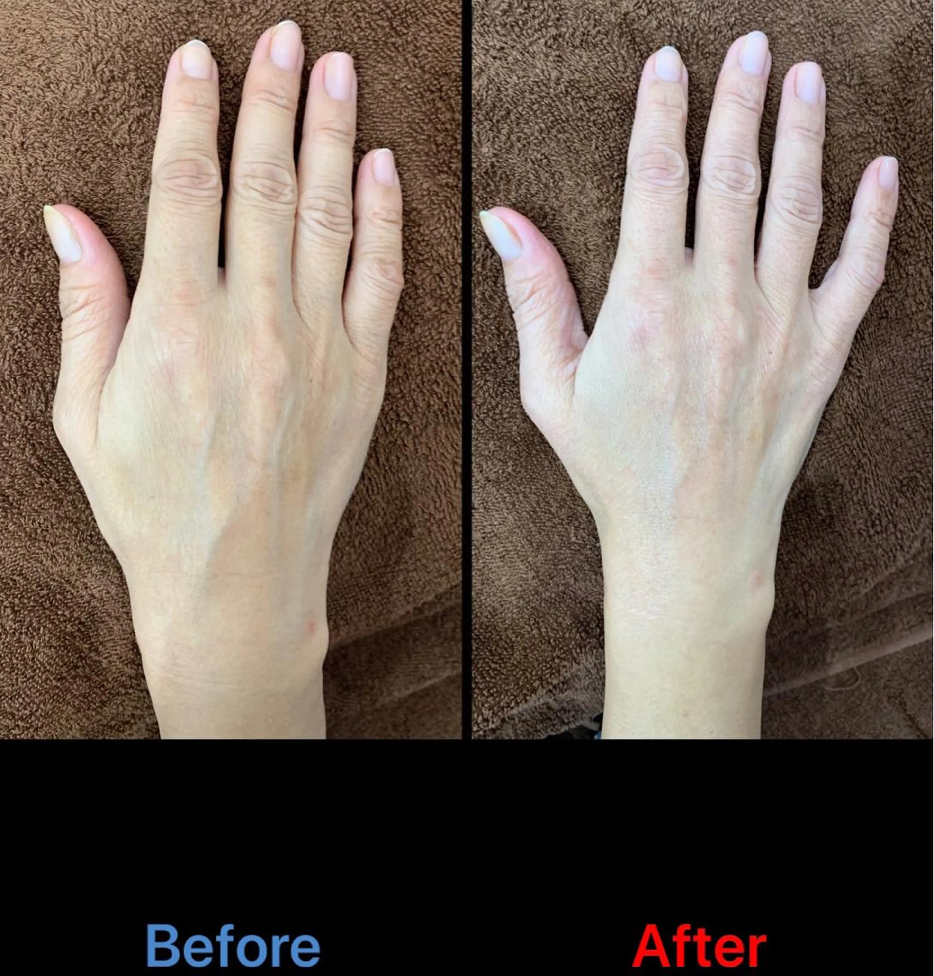 ウォーターケア・指毛の脱毛・角質ケア・ハンド光エステ・パック込み　￥6600の写真