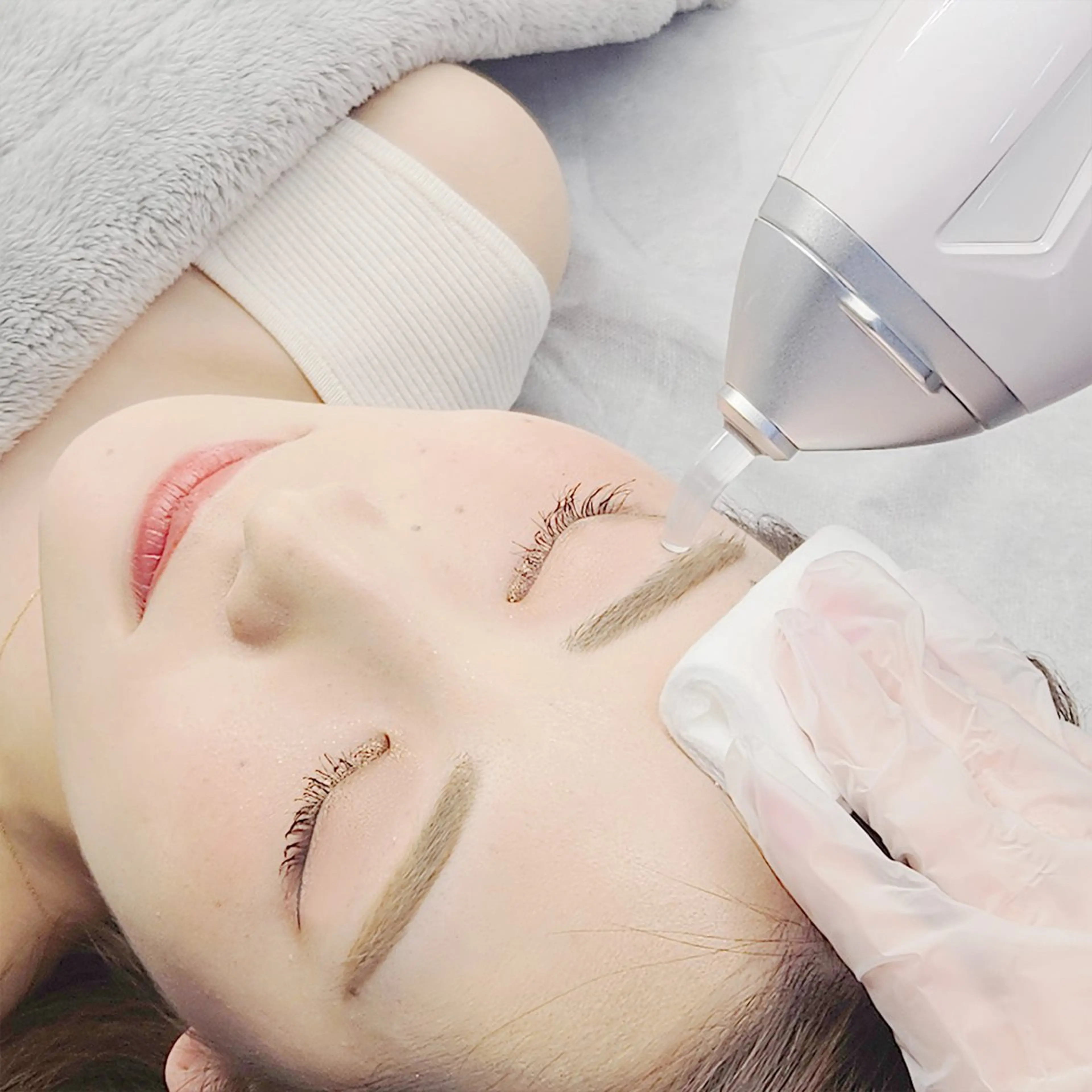 【LEDハイブリッド脱毛】産毛もお任せ♪口周り脱毛の写真