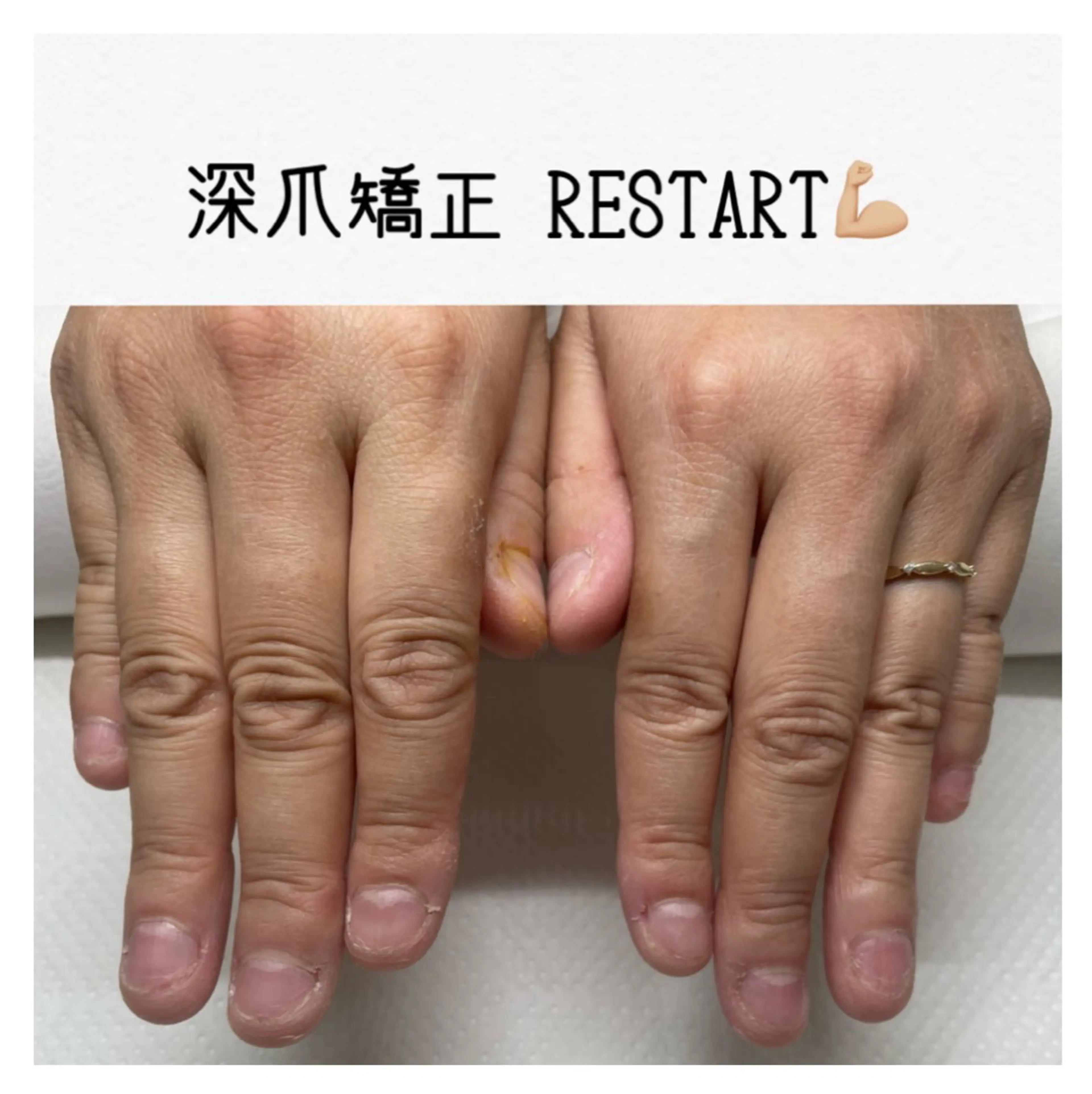 ネイル nail salon petillantのネイルデザイン