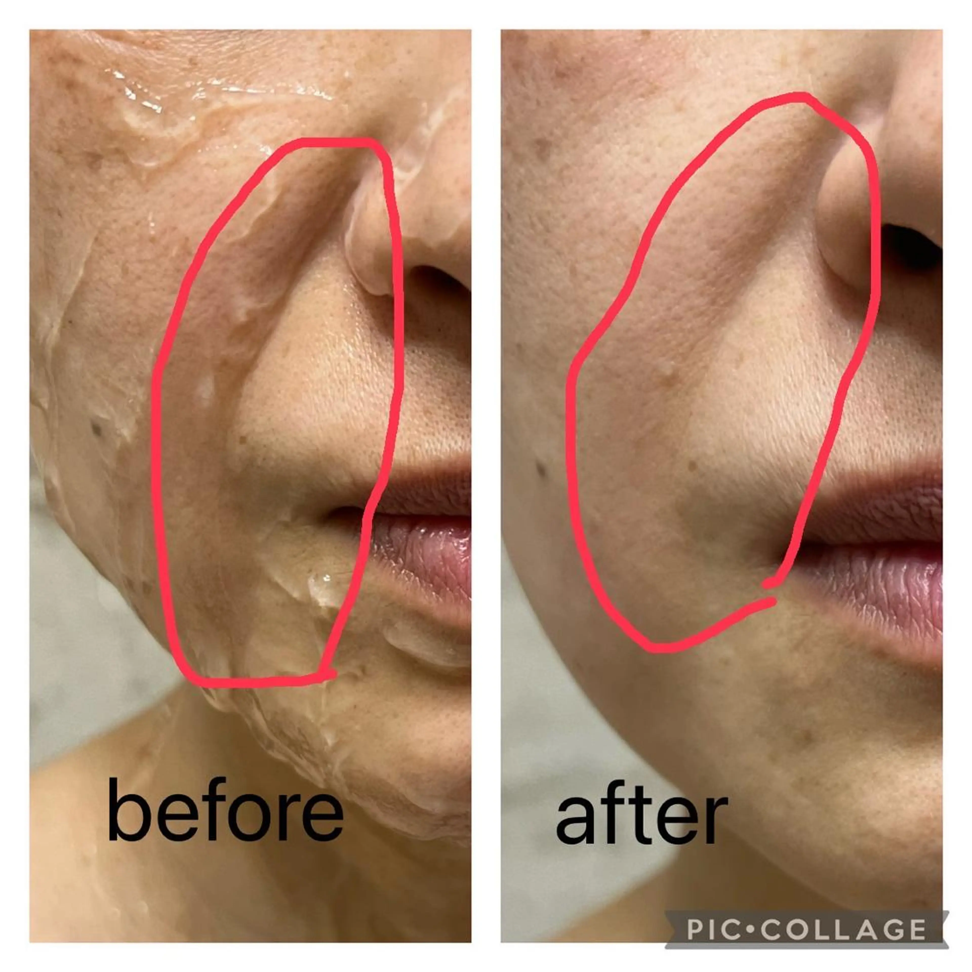 エステ M.rose エムローズのエステ・リラクイメージ