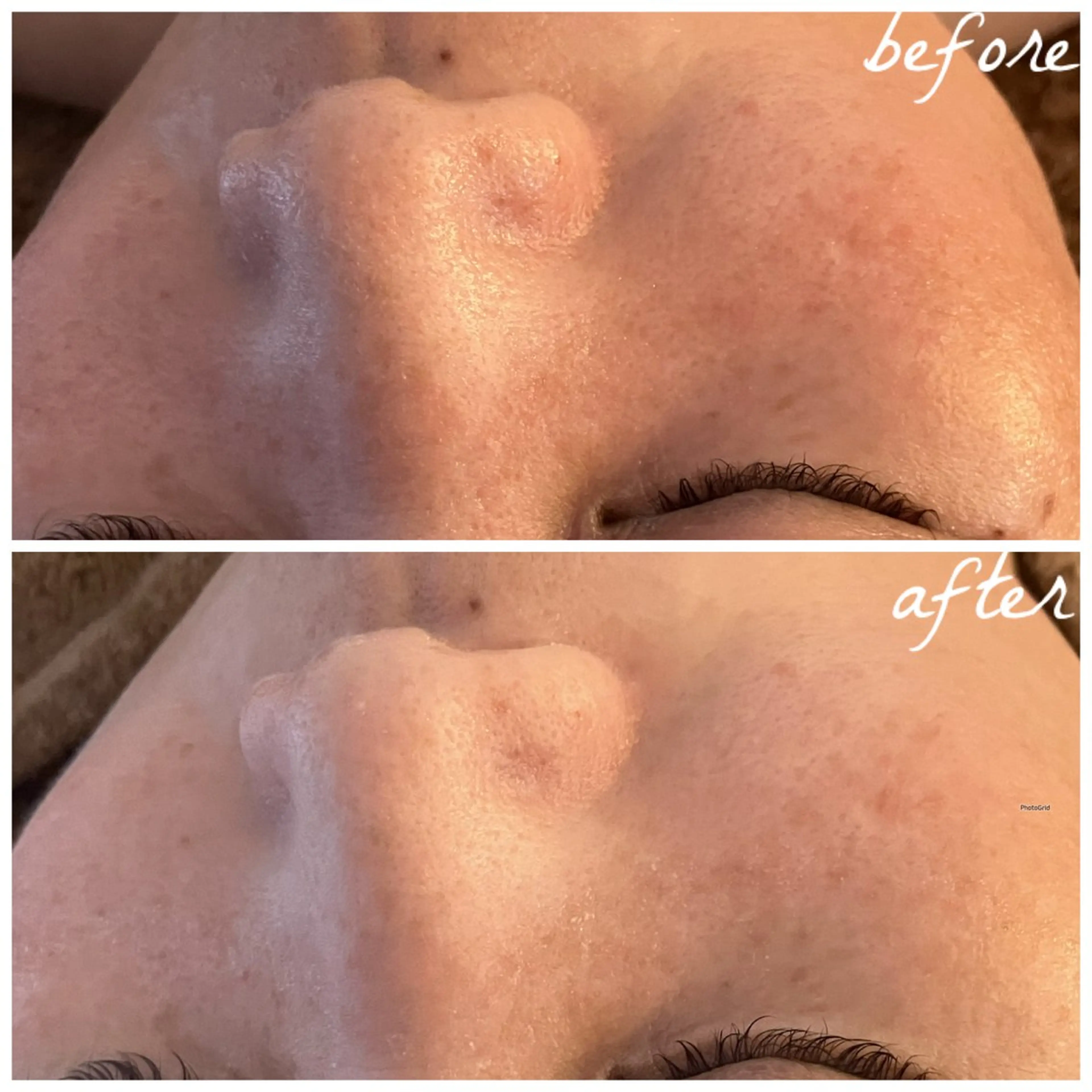 メンズ エステ メナード岐阜茜部 杉浦のエステ・リラクイメージ