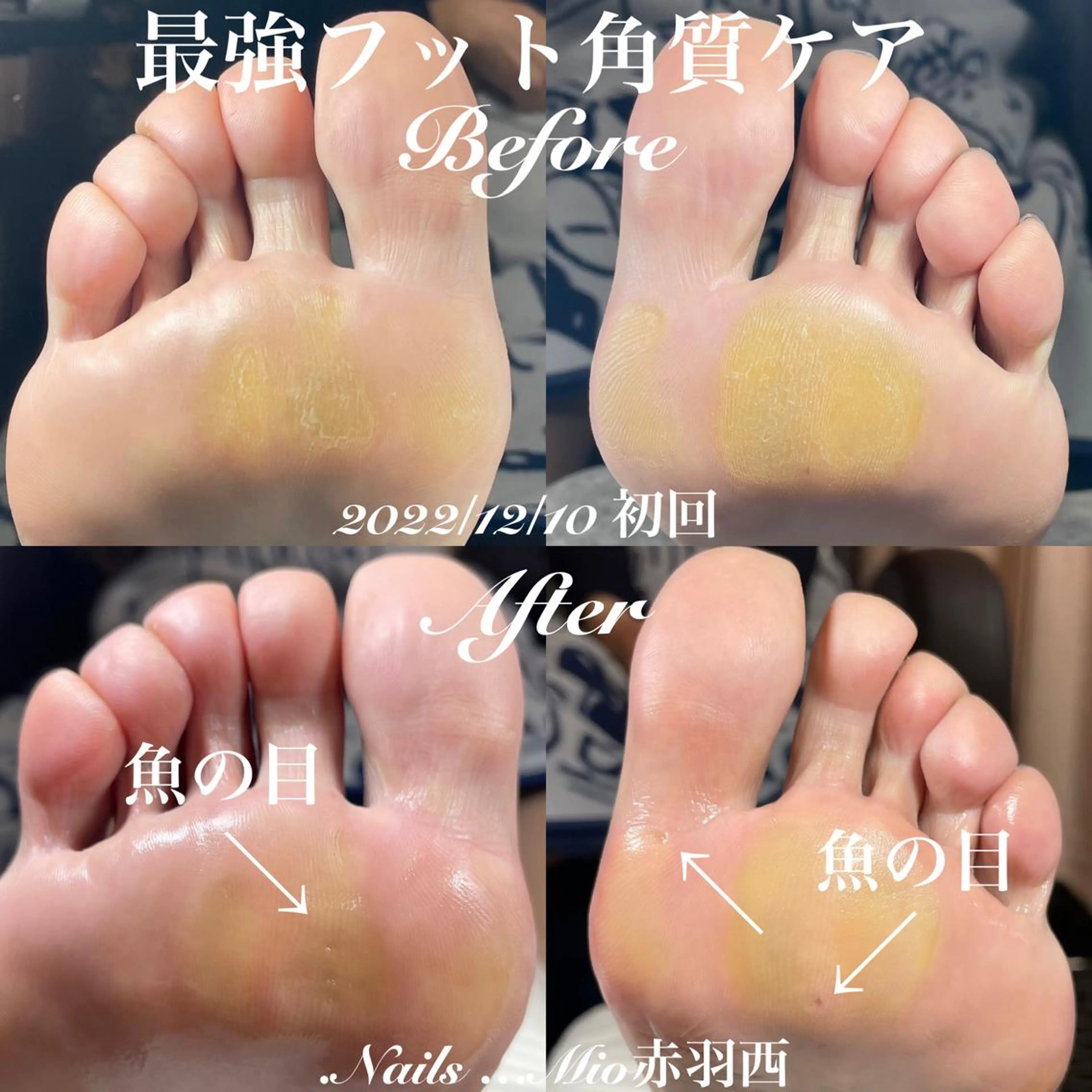 ネイル フットネイル フットネイル .Nails Mio 赤羽西ネイルサロンのネイルデザイン