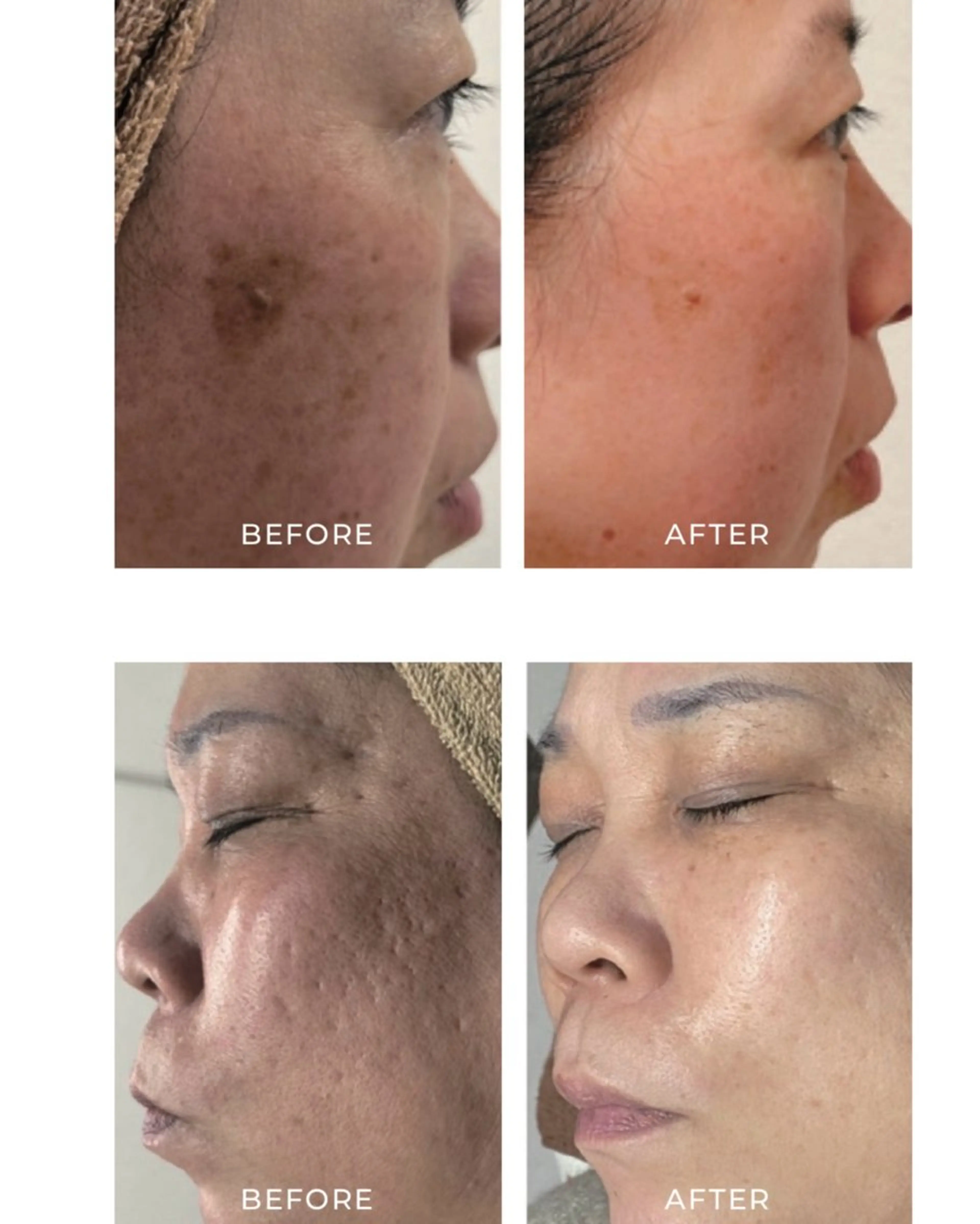 Luca 痩身• 疲労改善×韓国肌管理のエステ・リラクイメージ