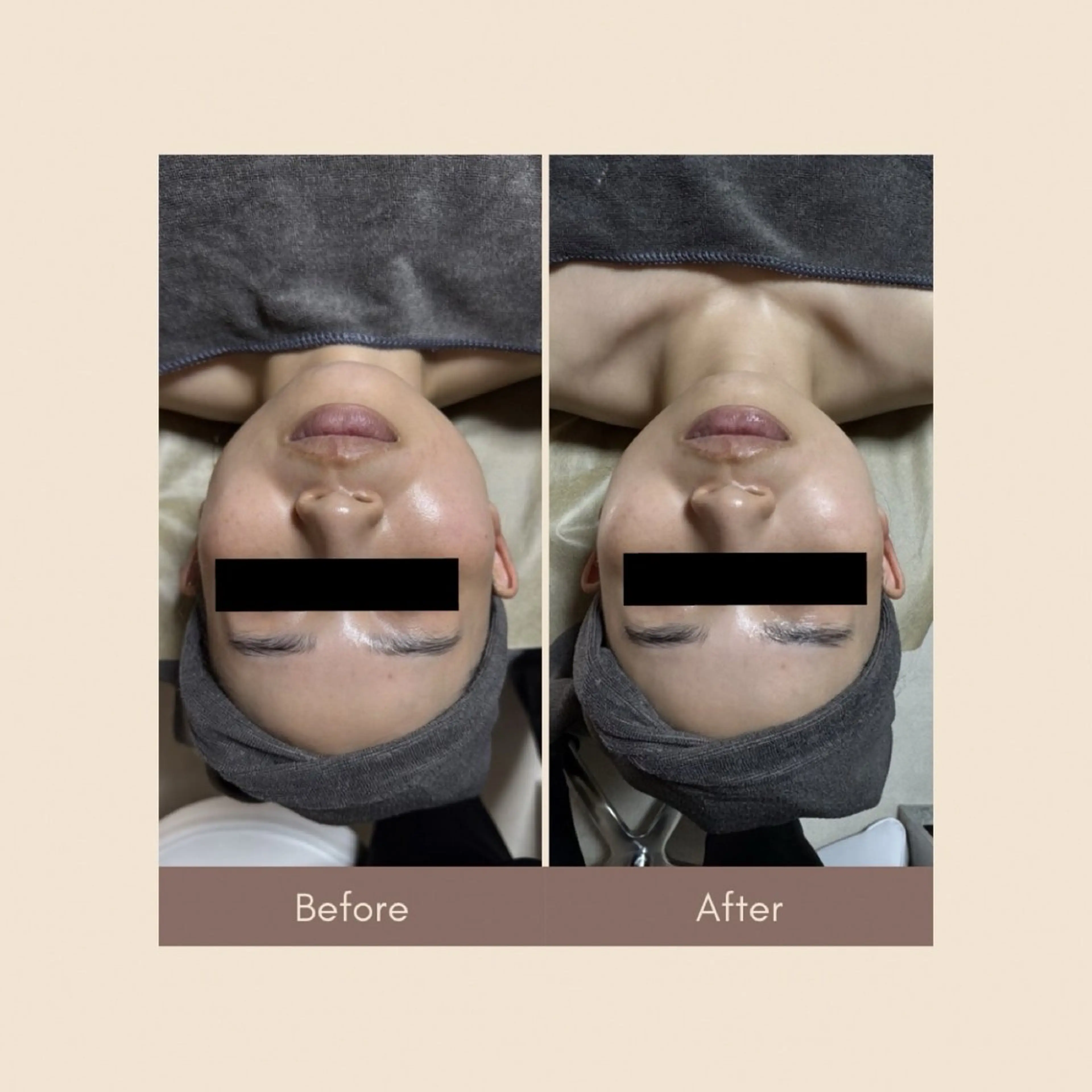 エステ ROR Nanaのエステ・リラクイメージ