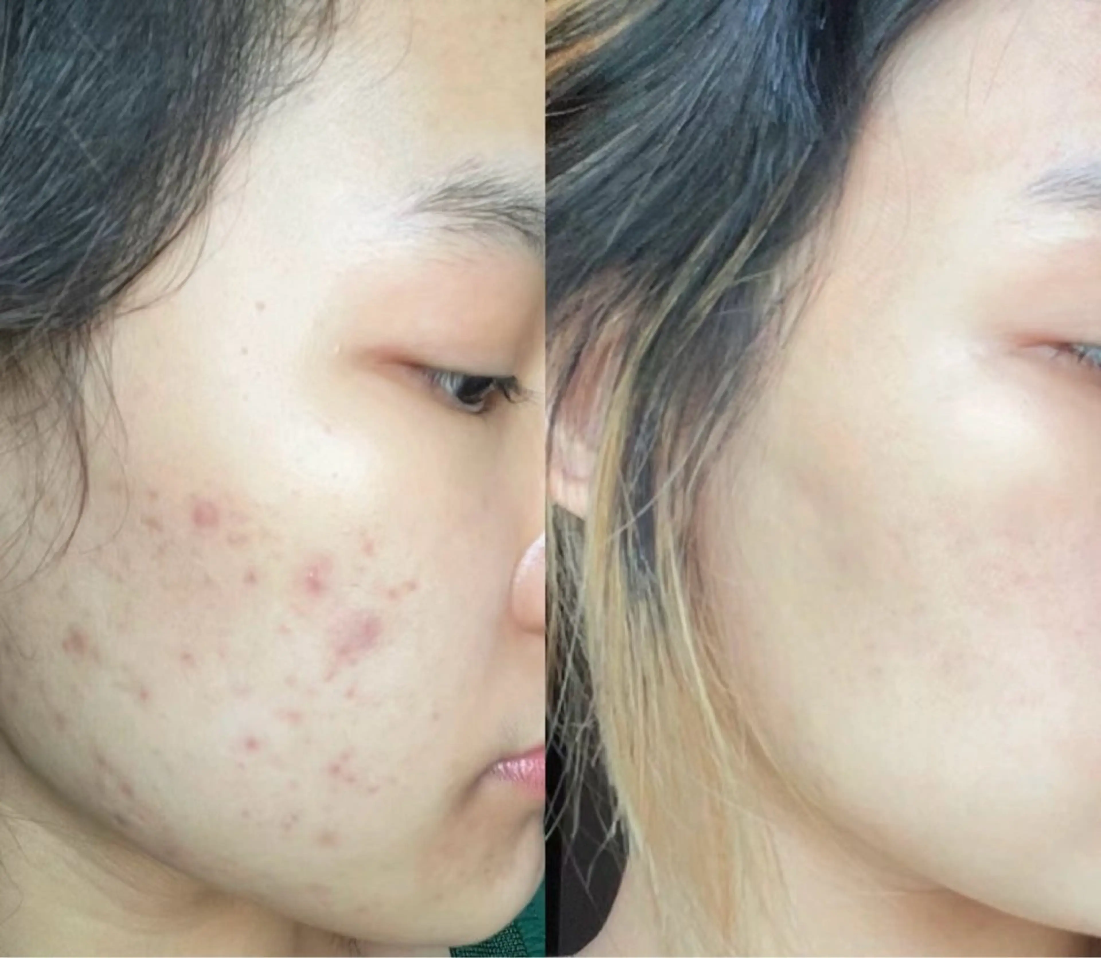 マツエク・マツパ エステ aliaハイフ&水光ジェットサロン所属・aliaハーブ水光店 エステティシャン募集のエステ・リラクイメージ