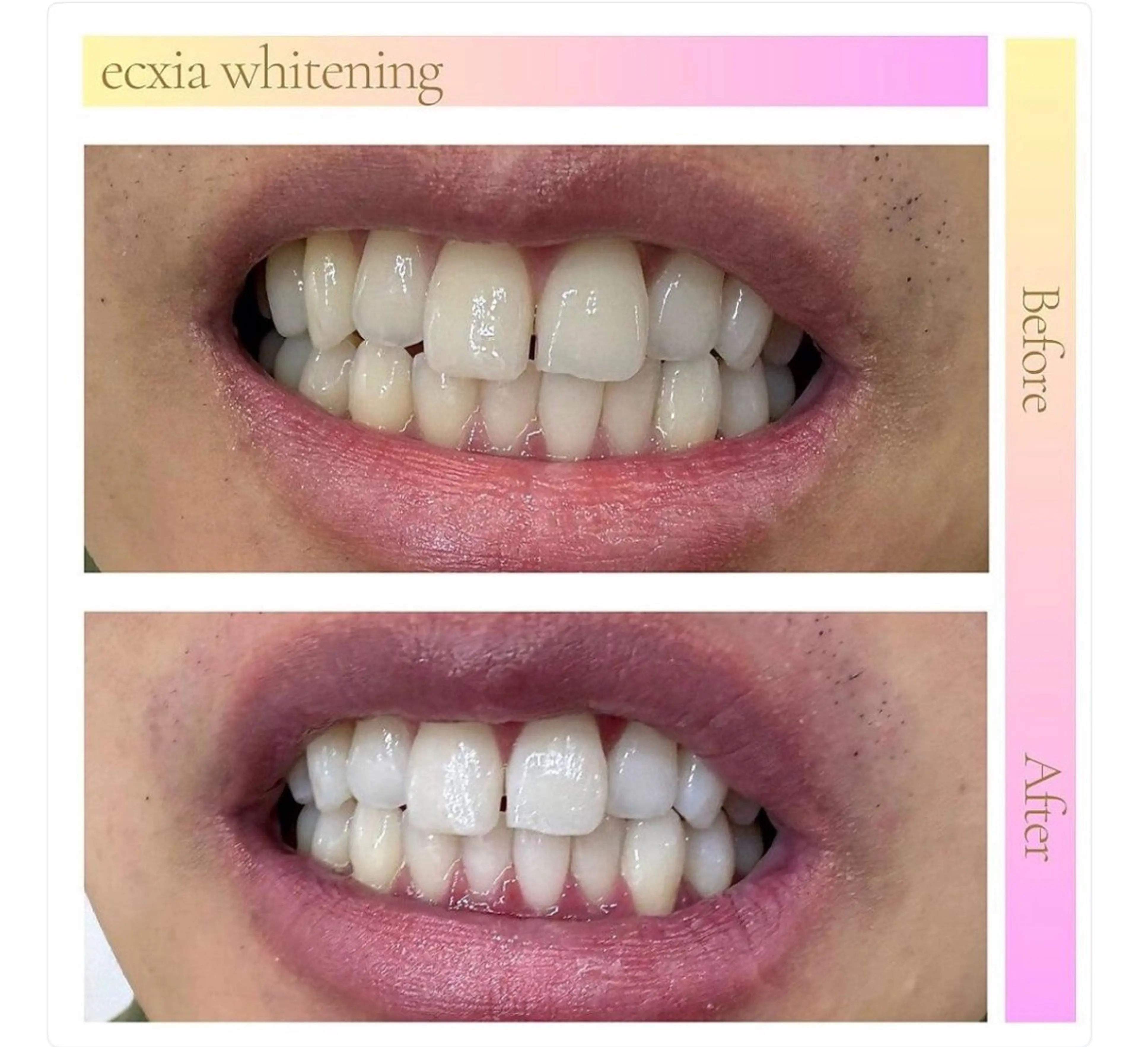 その他 ecxia新白河店 ゆきのその他イメージ