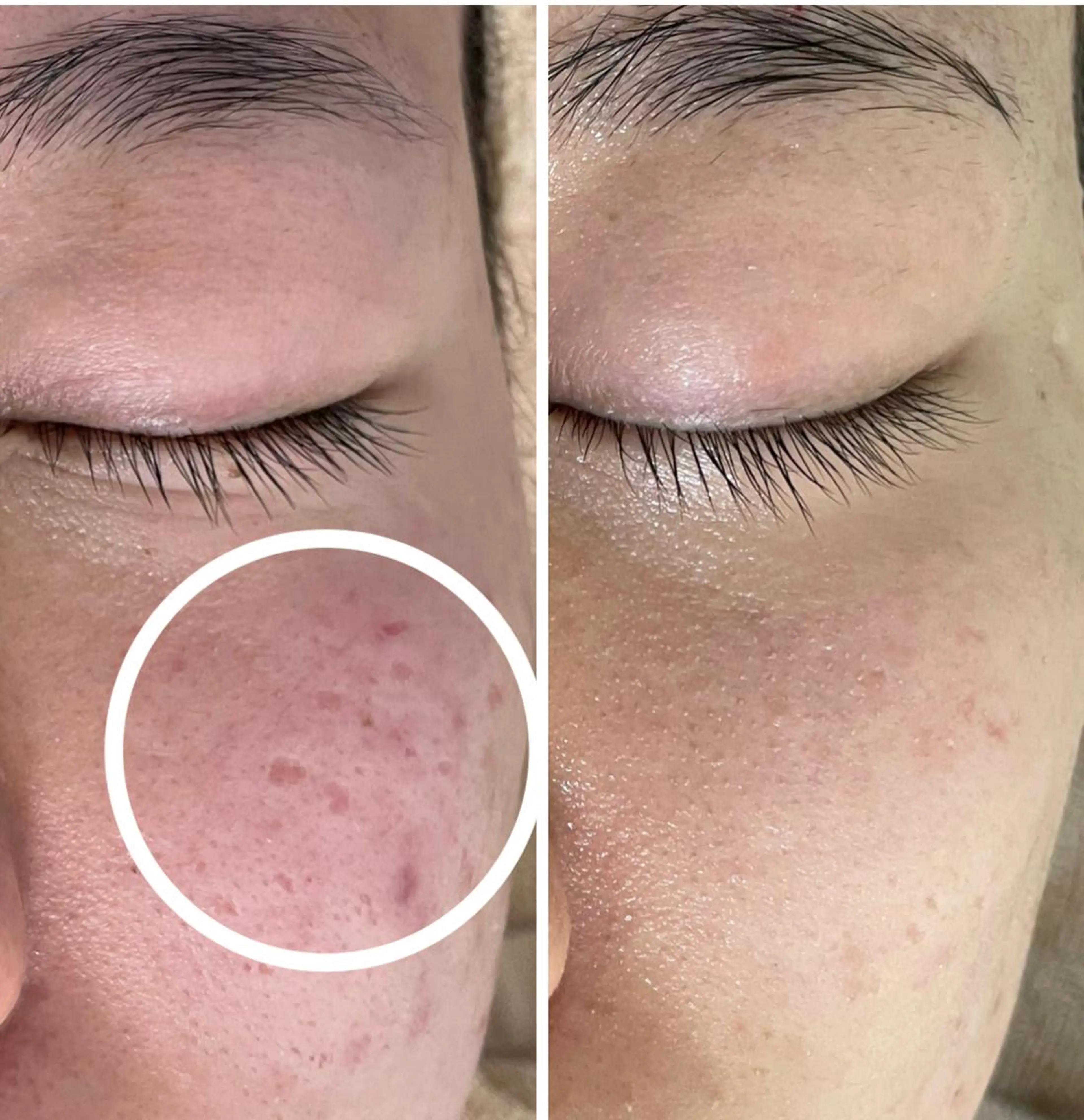 ショート カラー パーマ ヘアアレンジ メンズ キッズ ネイル マツエク・マツパ エステ ニキビ&跡改善サロン オーナー光木のエステ・リラクイメージ