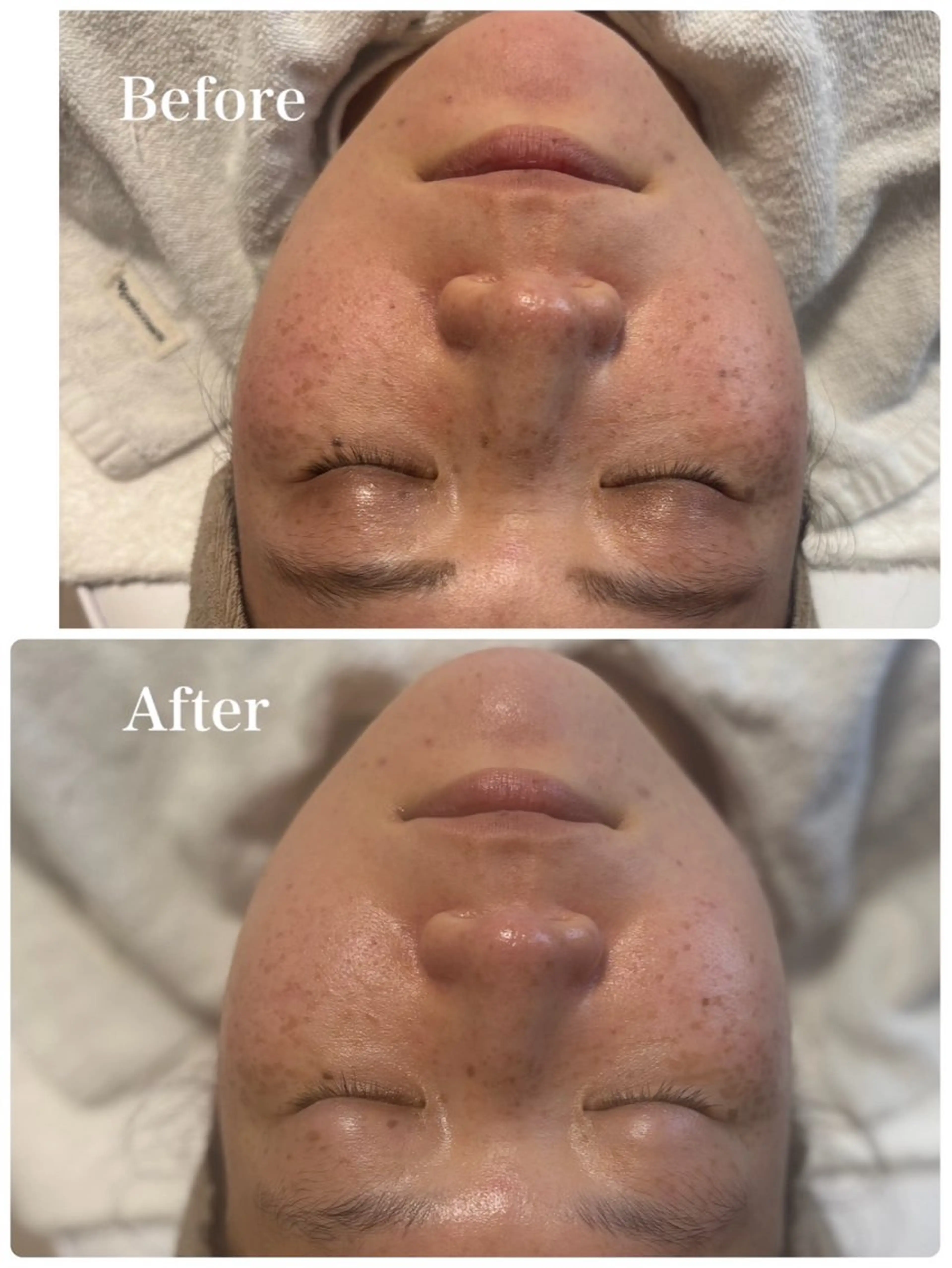 De I'm 加古川所属・宮澤 香のエステ・リラクイメージ