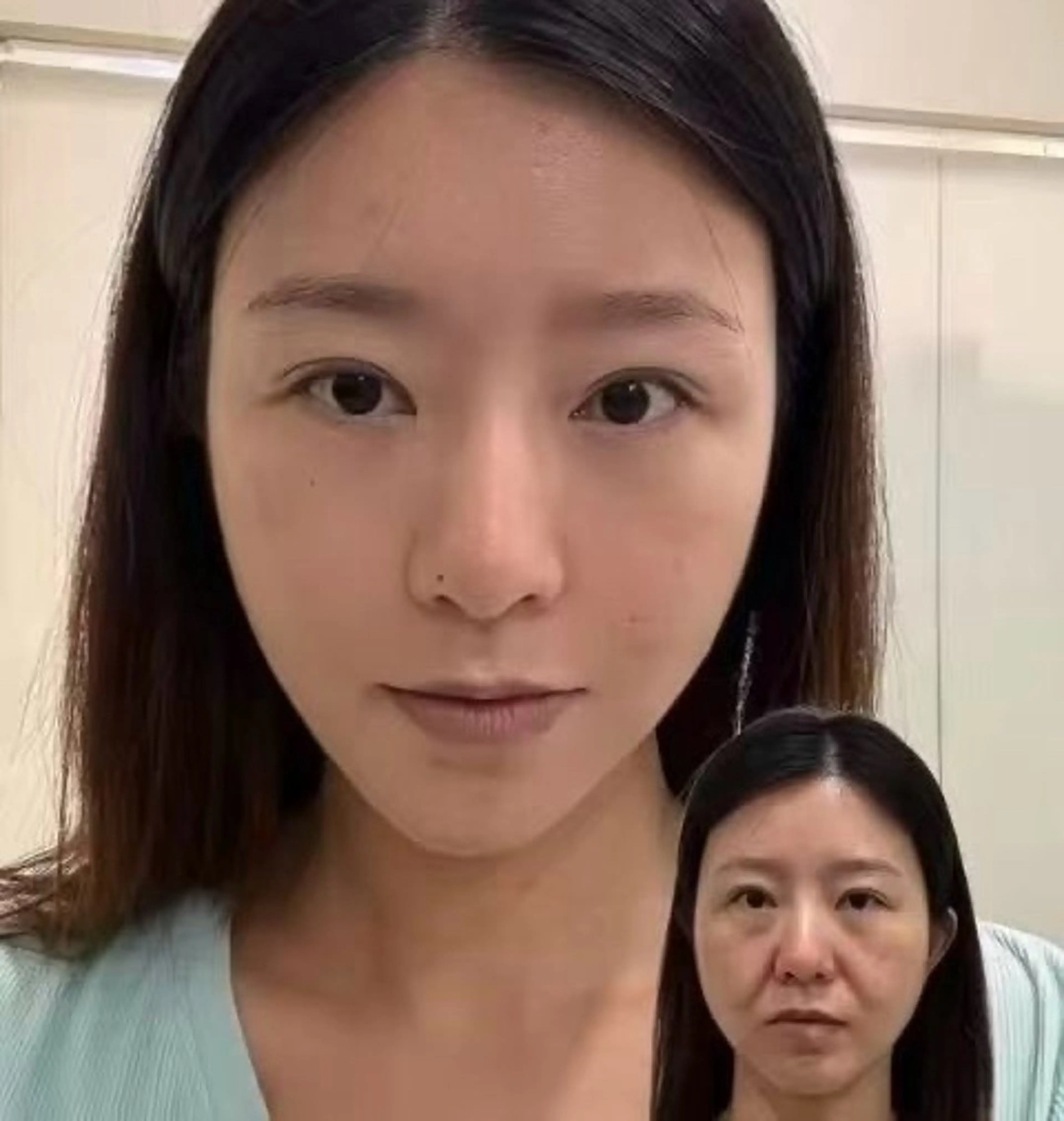 パーマ エステ aliaハイフ&水光ジェットサロン所属・aliaハーブ水光店 エステティシャン募集のエステ・リラクイメージ