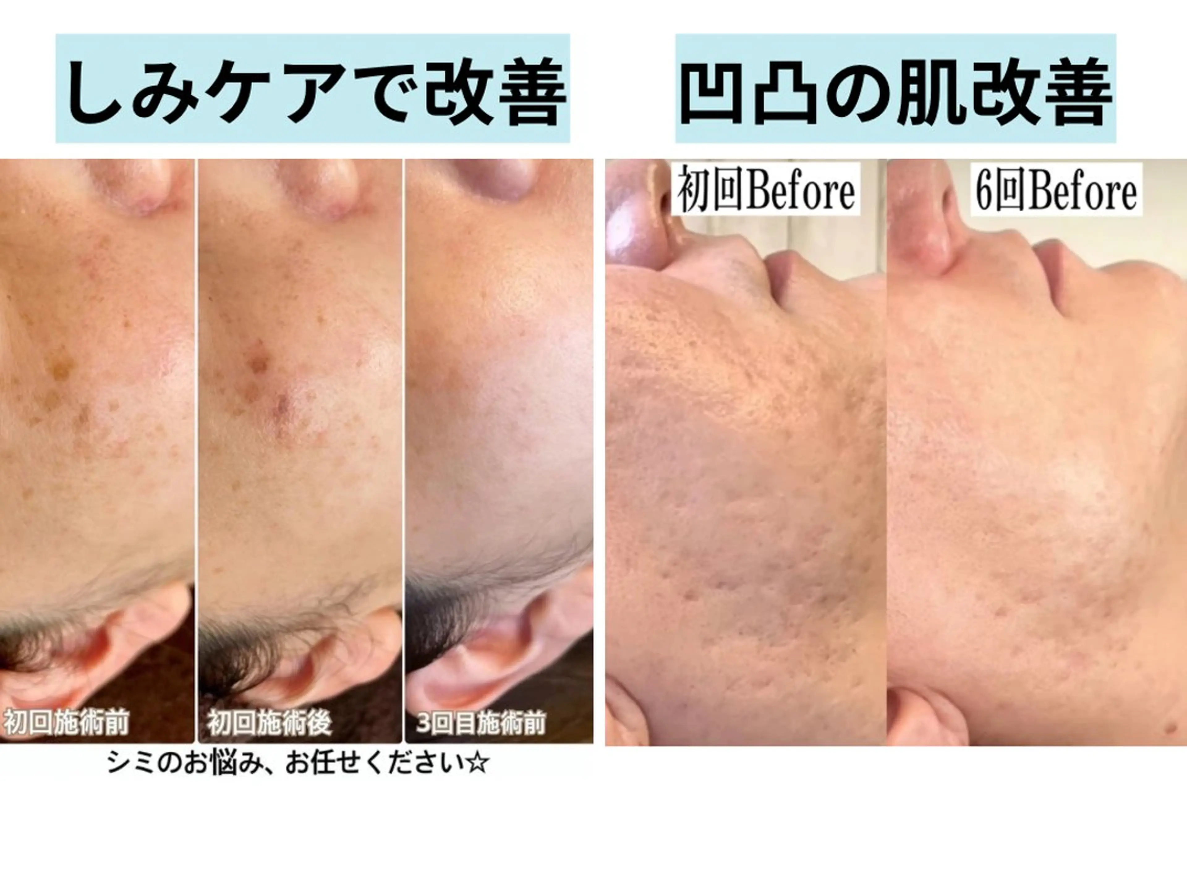 エステ 枝廣 貴子のエステ・リラクイメージ