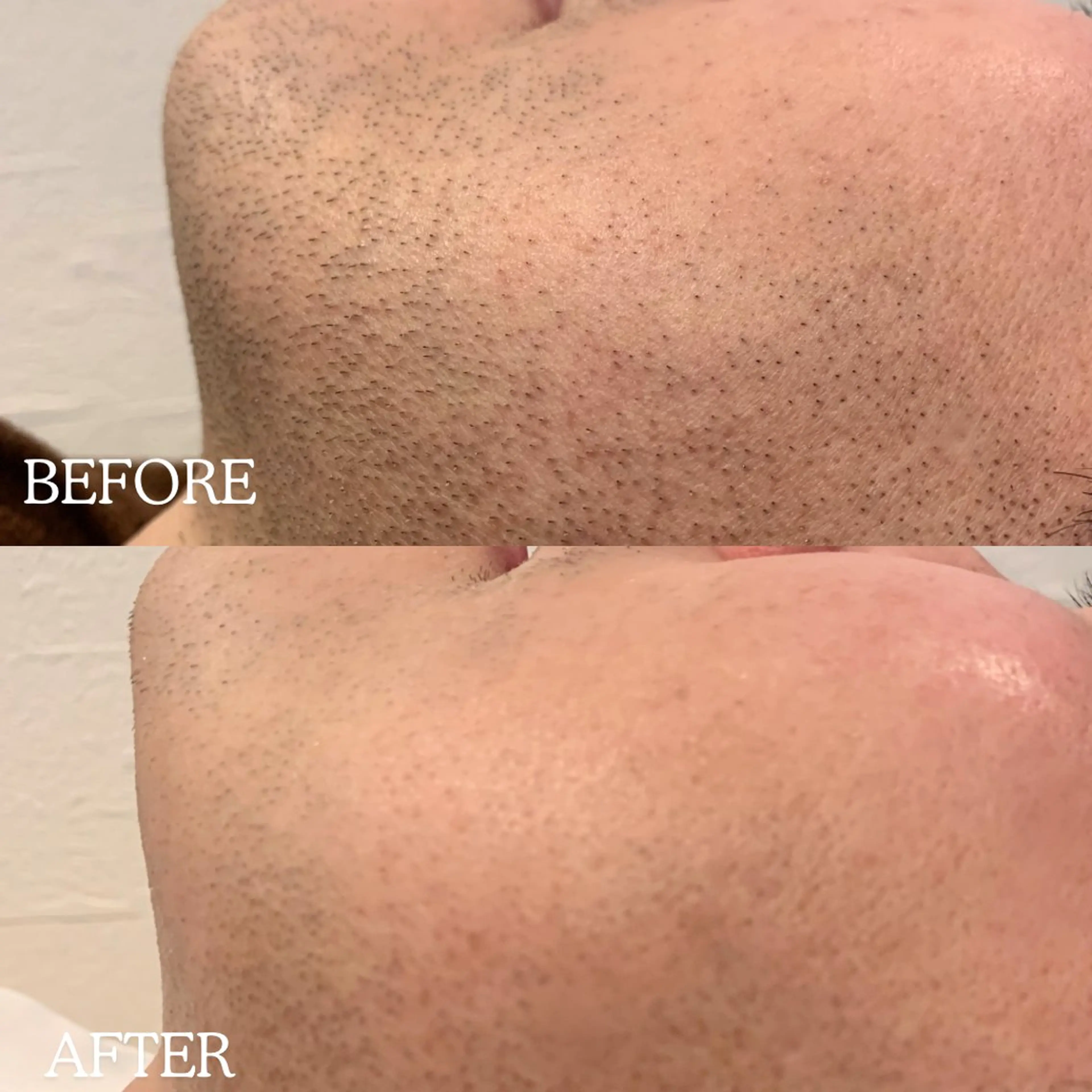 メンズ 脱毛 RICCO 堺の眉毛・アイブロウイメージ