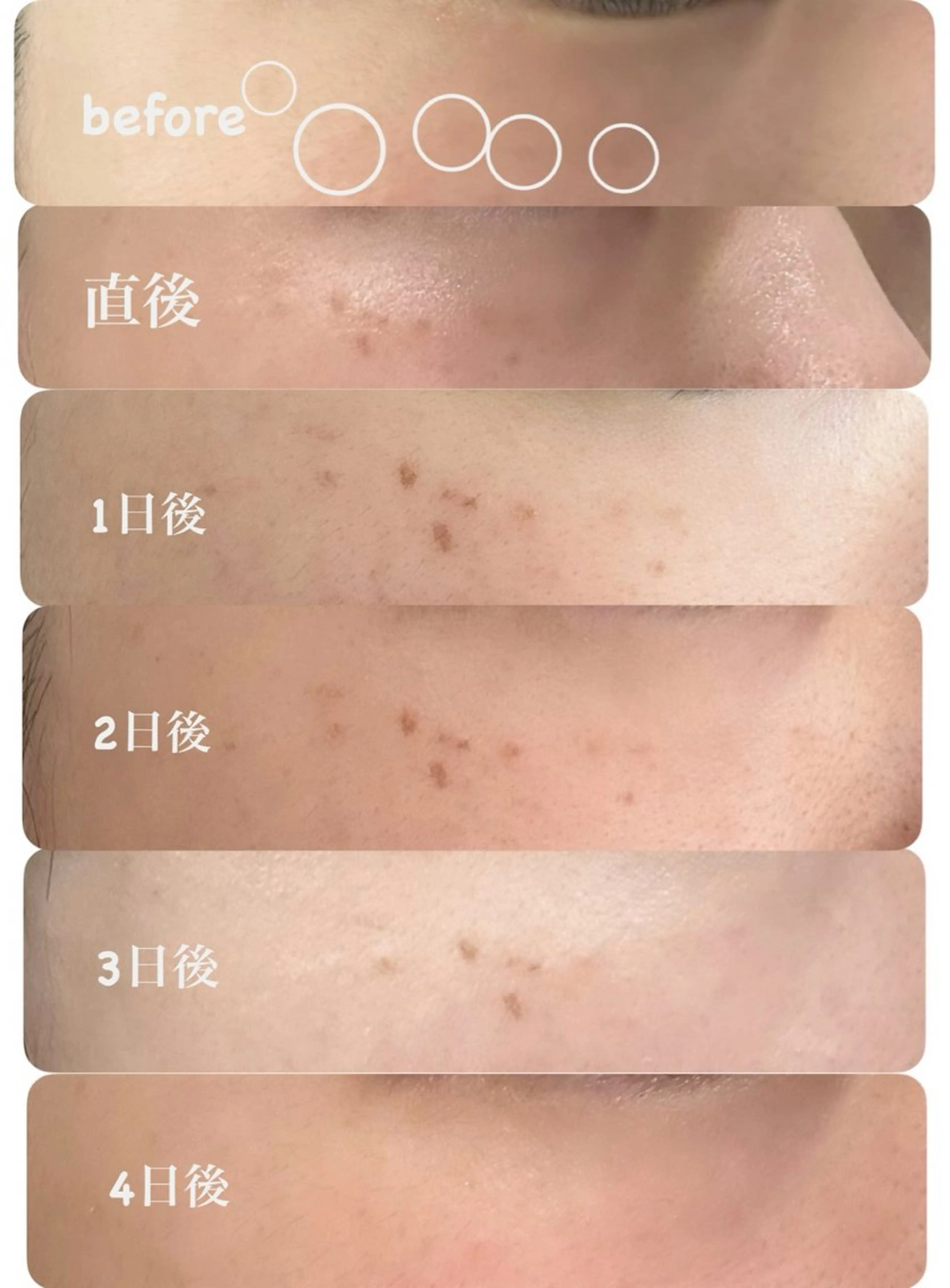 エステ トータルしみケア専門 NICA(ニカ)の眉毛・アイブロウイメージ