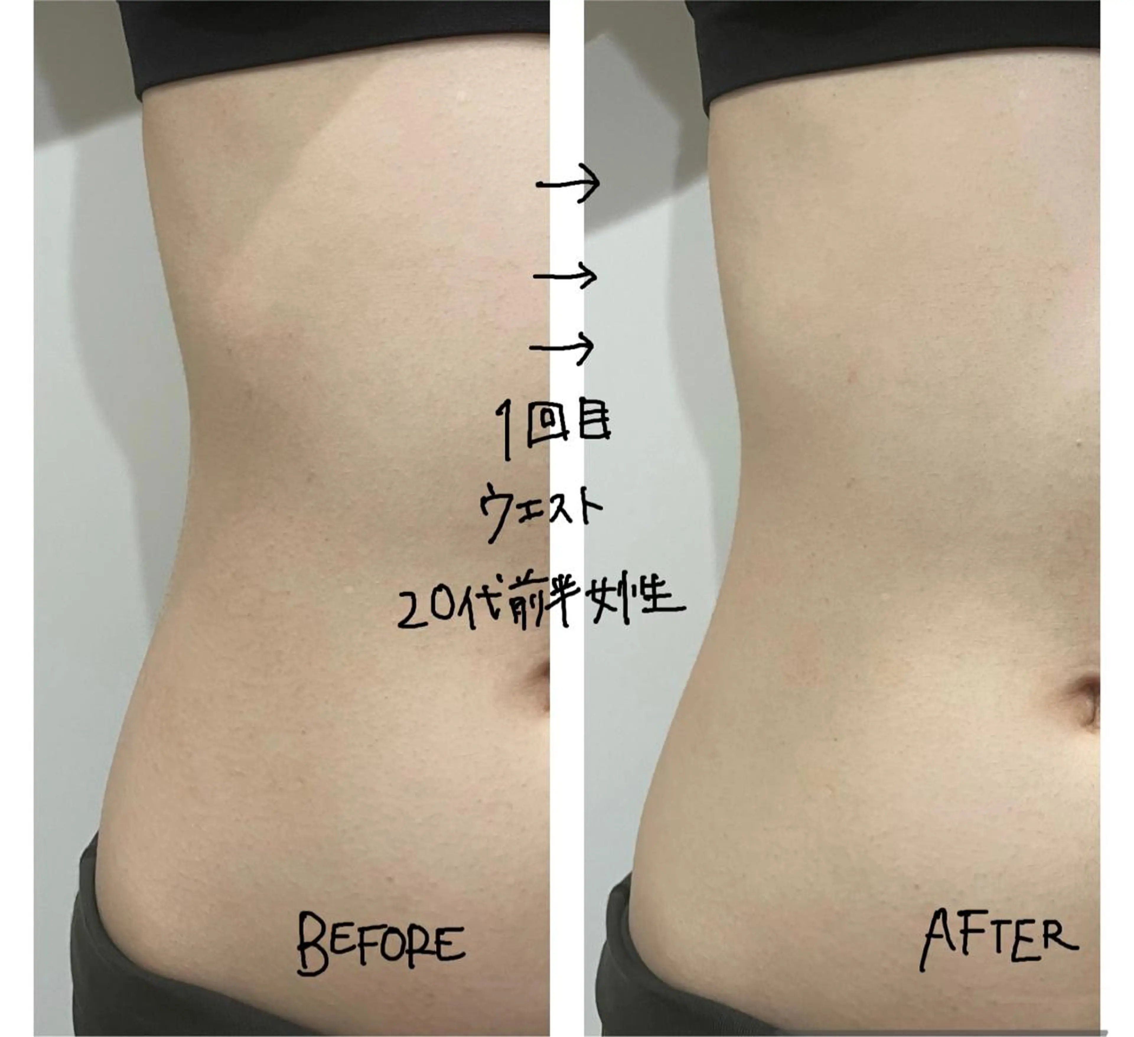 エステ ENCHANT 脱毛.小顔.毛穴のエステ・リラクイメージ