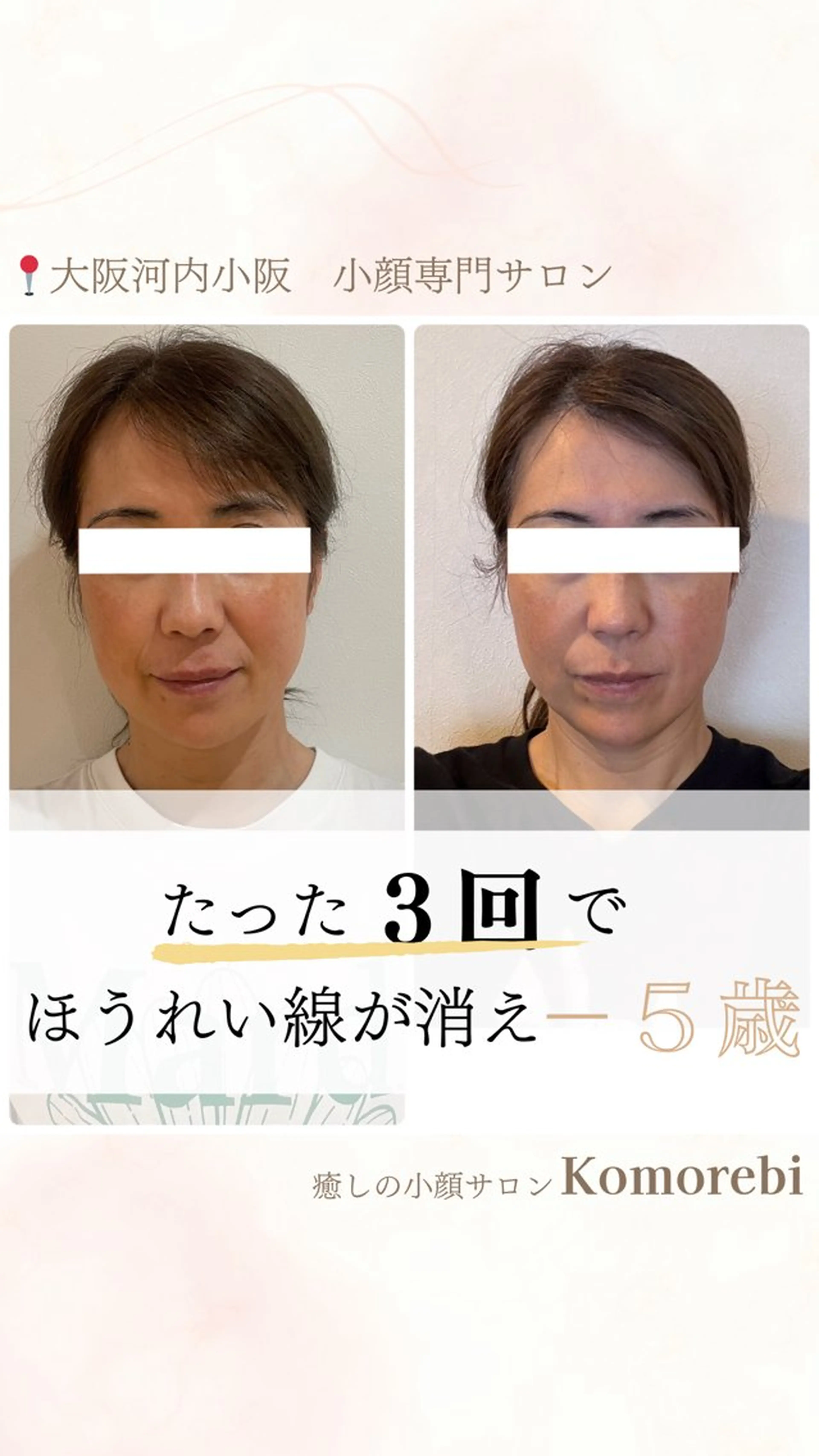 営業電話❌小顔サロン Komorebiのエステ・リラクイメージ