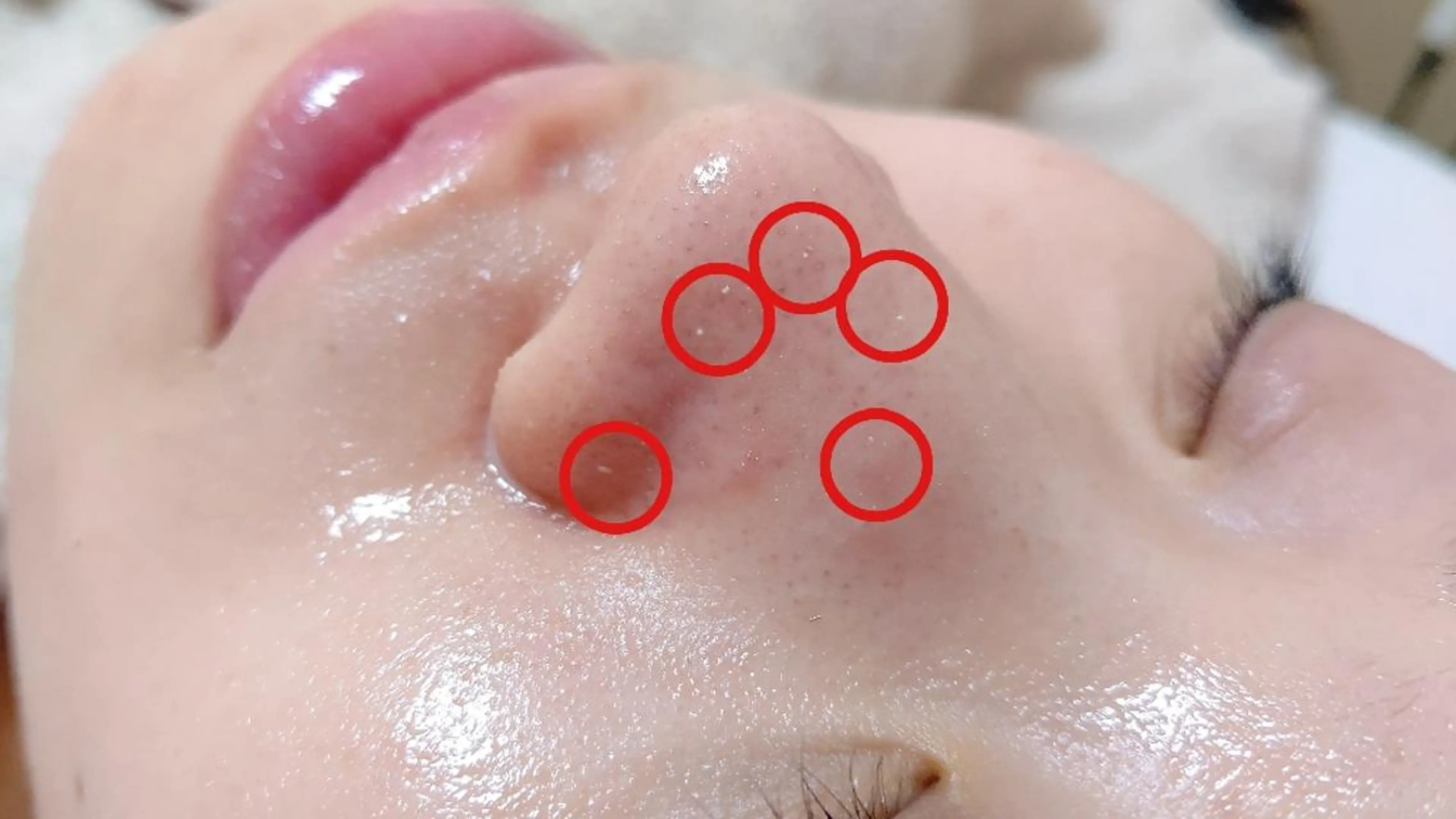 DeRiii 毛穴・ 保湿ケアまつ毛パーマのエステ・リラクイメージ