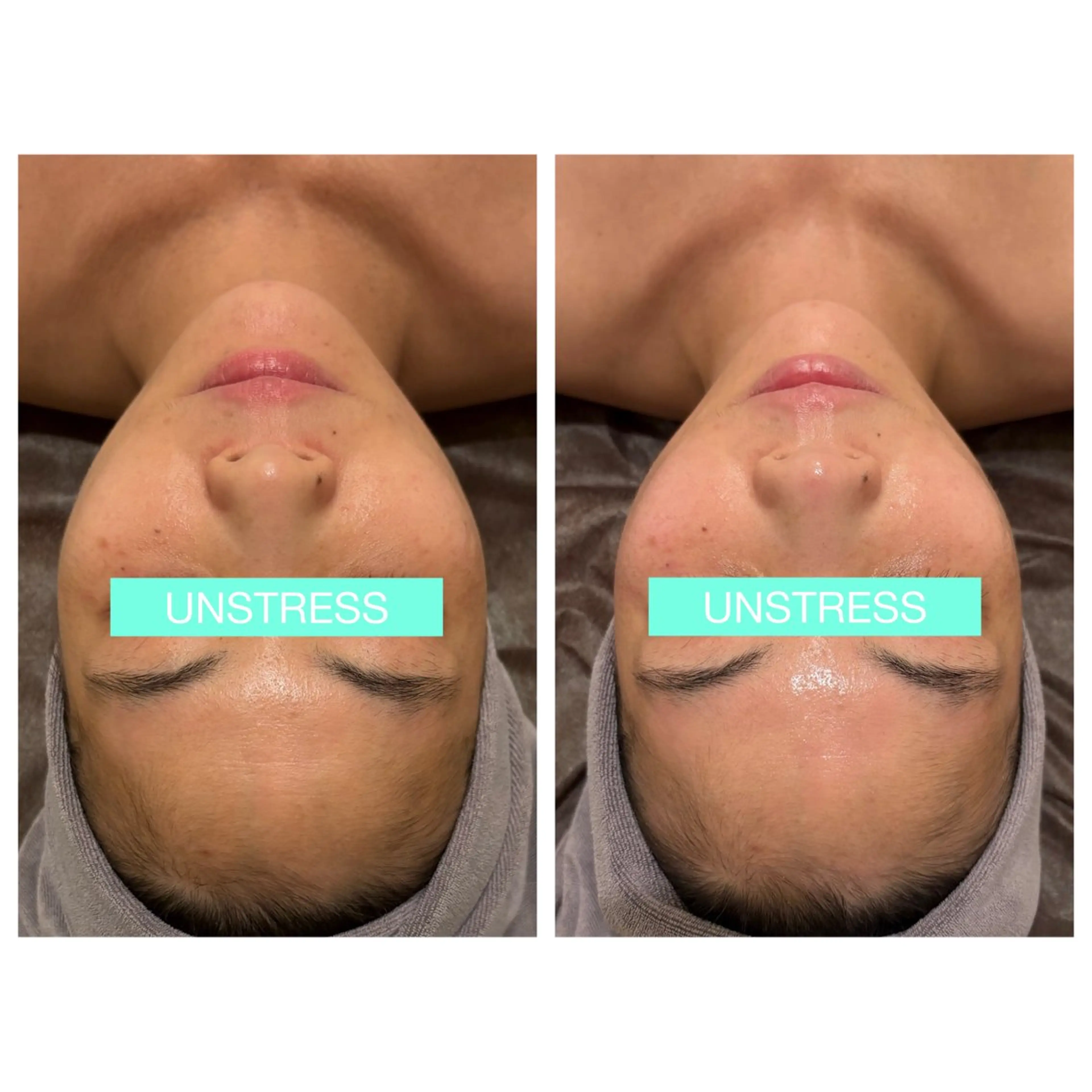 小顔コルギ ☆表参道/外苑前のエステ・リラクイメージ