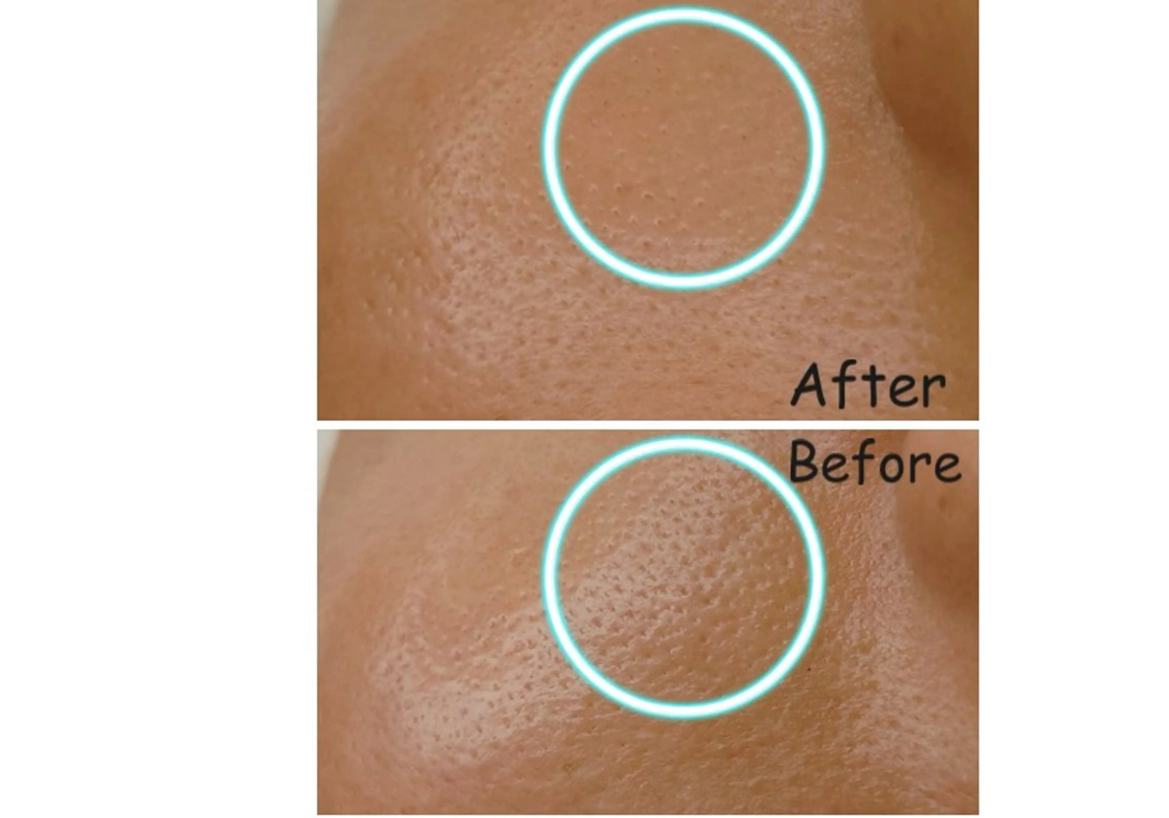 毛穴改善フェイシャル 夏秋美肌サロンのエステ・リラクイメージ