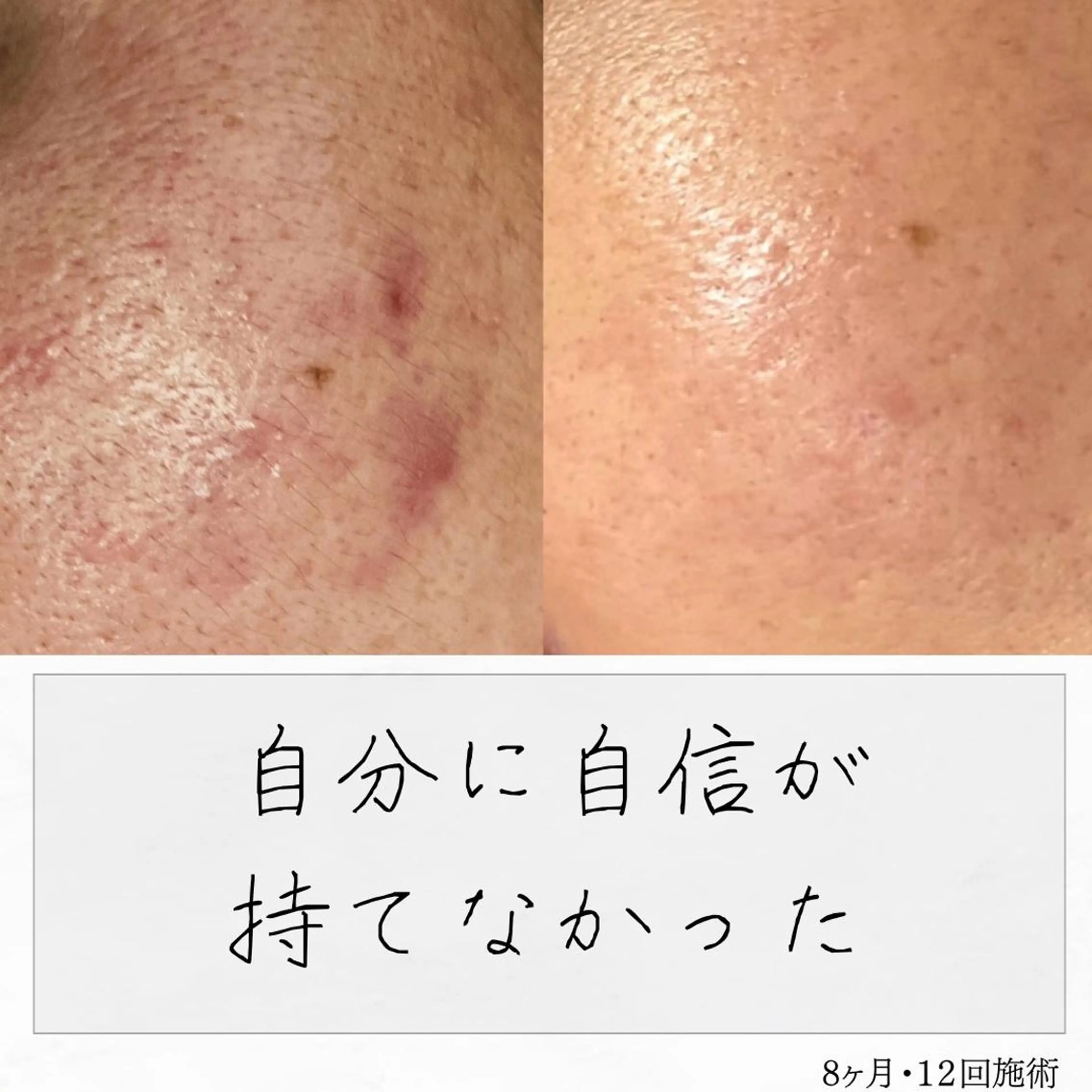 ニキビ経験者が施術 する専門サロン🌻のエステ・リラクイメージ