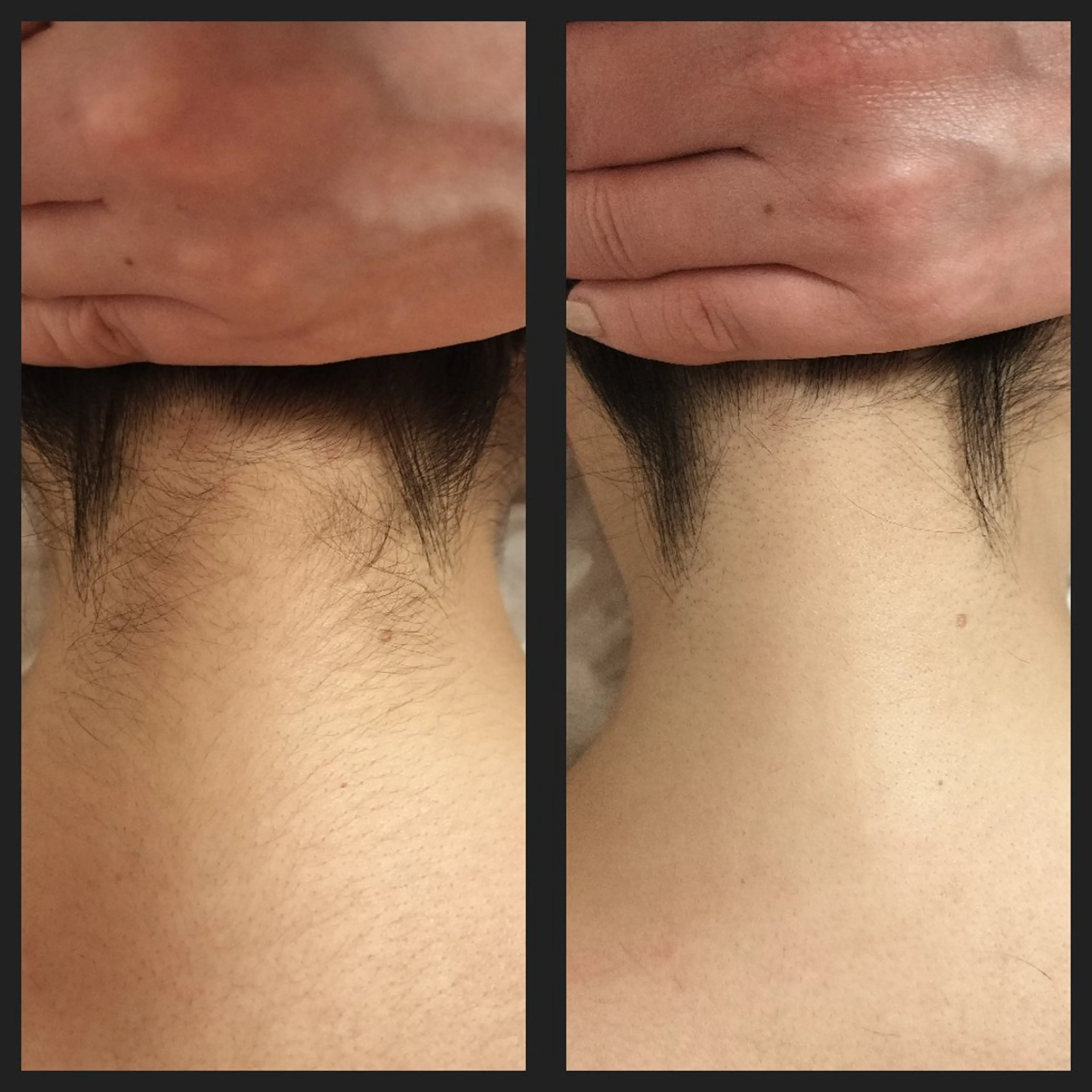 脱毛 エステサロン Re：Charge所属・Re:Charge 古川小百合のエステ・リラクイメージ