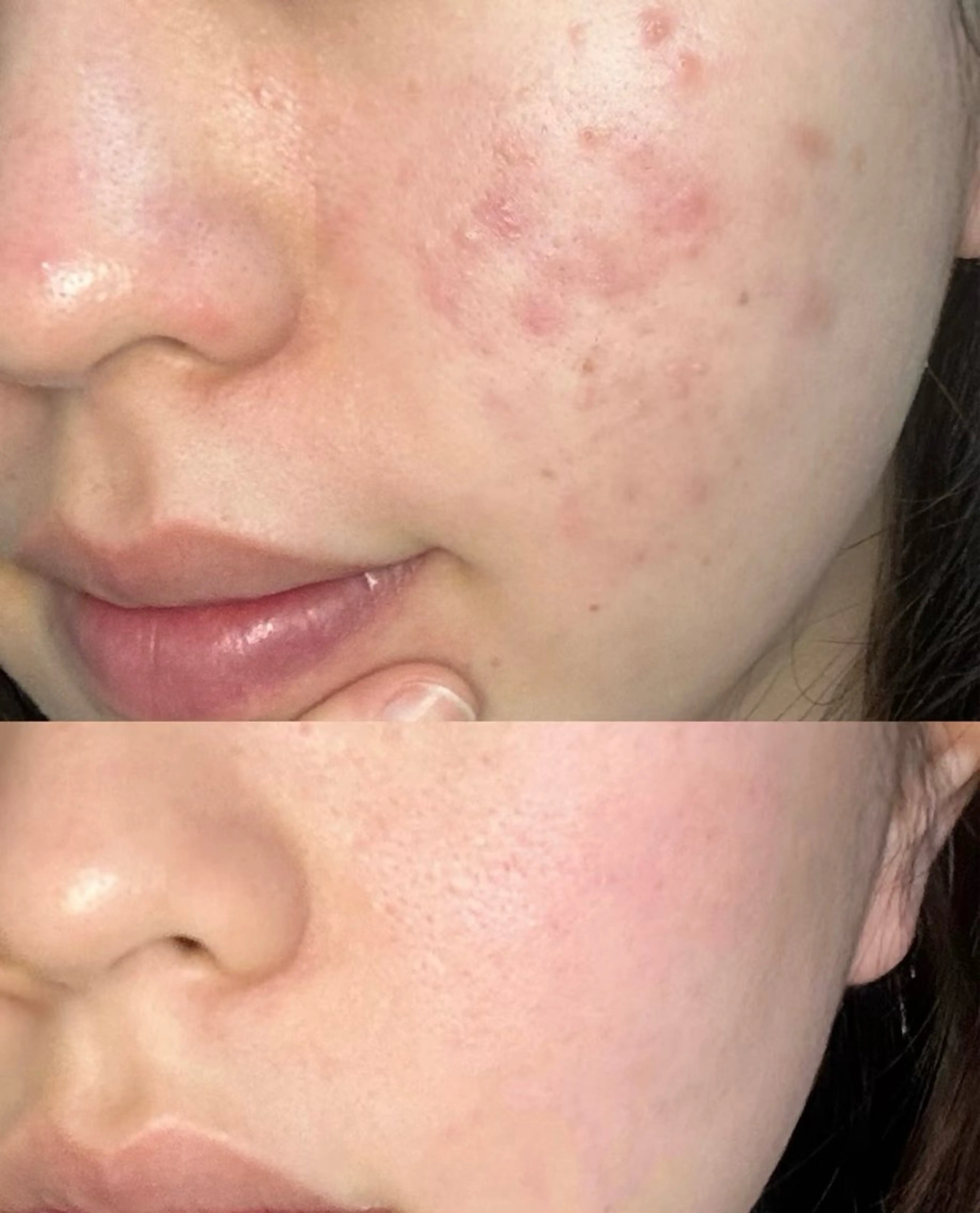 ネイル エステ aliaハーブ水光店 エステティシャン募集のエステ・リラクイメージ