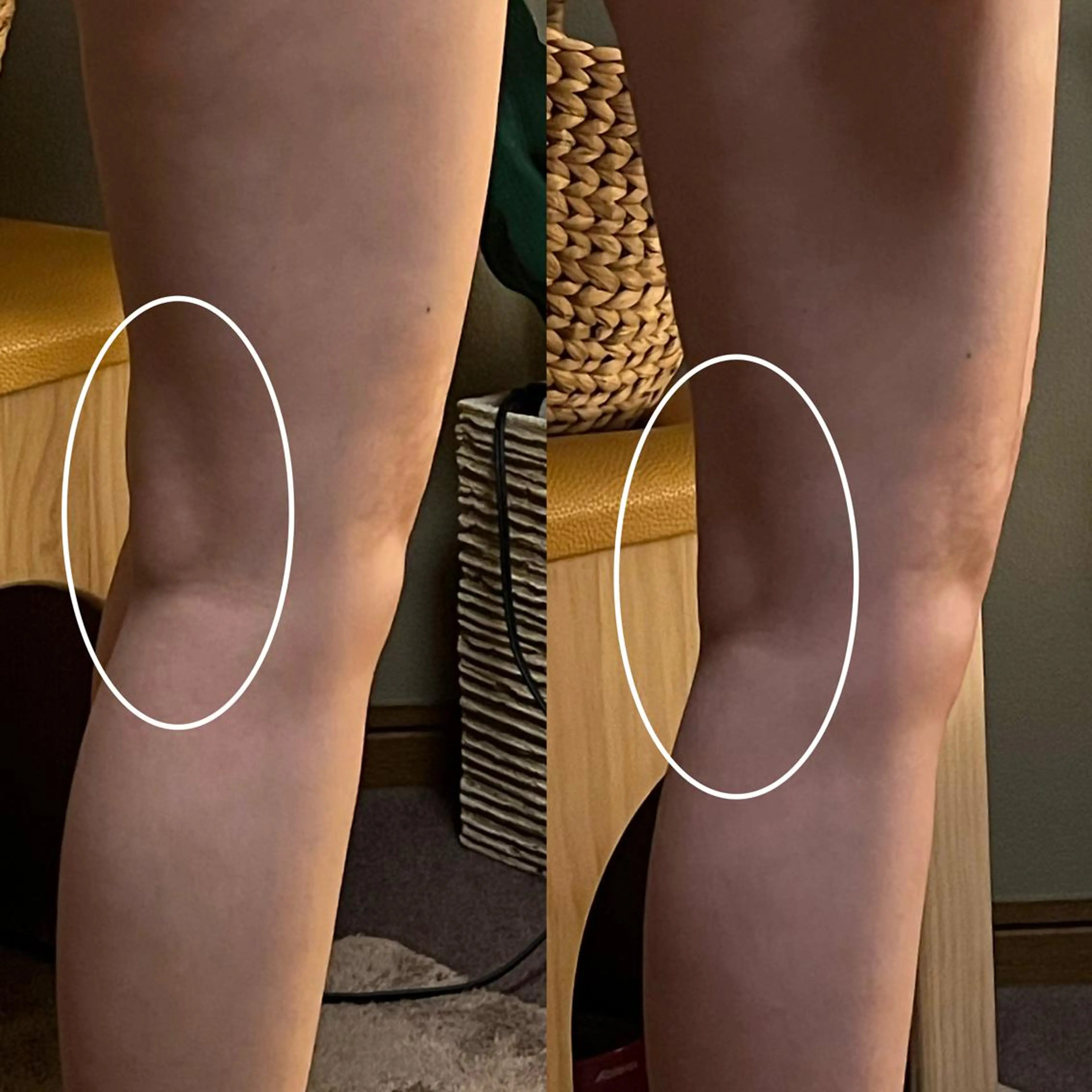 エステ リラク lymph care 'Welnəsのエステ・リラクイメージ